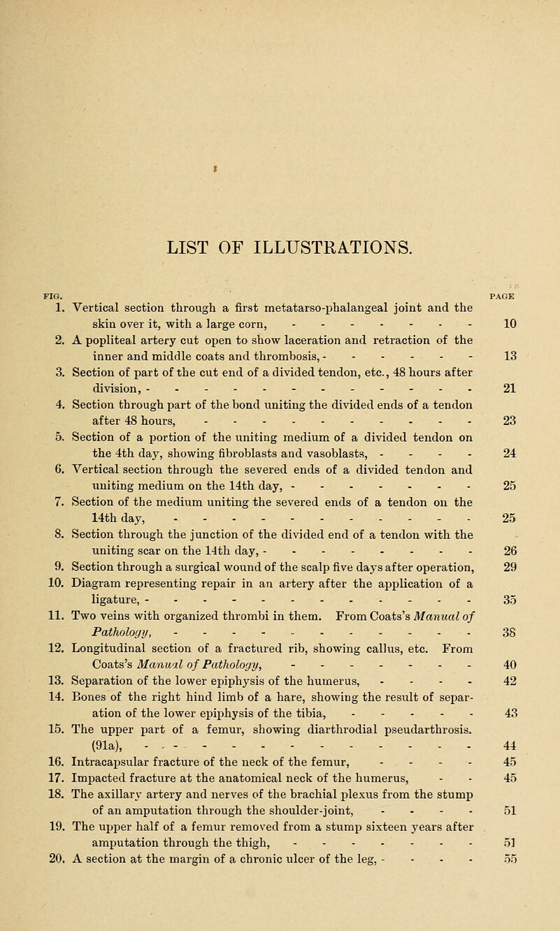 FIG. PAGE 1. Vertical section through a first metatarso-phalangeal joint and the skin over it, with a large corn, 10 2. A popliteal artery cut open to show laceration and retraction of the inner and middle coats and thrombosis, 13 3. Section of part of the cut end of a divided tendon, etc., 48 hours after division, -.--.------. 21 4. Section through part of the bond uniting the divided ends of a tendon after 48 hours, 23 5. Section of a portion of the uniting medium of a divided tendon on the 4th day, showing fibroblasts and vasoblasts, . - - - 24 6. Vertical section through the severed ends of a divided tendon and uniting medium on the 14th day, 25 7. Section of the medium uniting the severed ends of a tendon on the 14th day, 25 8. Section through the junction of the divided end of a tendon with the uniting scar on the 14tli day, 26 9. Section through a surgical wound of the scalp five days after operation, 29 10. Diagram representing repair in an artery after the application of a ligature, - . . - 35 11. Two veins with organized thrombi in them. From Coats's Manual of Pathology, 38 12. Longitudinal section of a fractured rib, showing callus, etc. From Coats's Manual of Pathology, - 40 13. Separation of the lower eiaiphysis of the humerus, .... 42 14. Bones of the right hind limb of a hare, showing the result of separ- ation of the lower epiphysis of the tibia, 43 15. The upper part of a femur, showing diarthrodial pseudarthrosis. (91a), - 44 16. Intracapsular fracture of the neck of the femur, . . - . 45 17. Impacted fracture at the anatomical neck of the humerus, - - 45 18. The axillary artery and nerves of the brachial plexus from the stump of an amputation through the shoulder-joint, .... 51 19. The ujjper half of a femur removed from a stump sixteen years after amputation through the thigh, 5] 20. A section at the margin of a chronic ulcer of the leg, - - . - .55