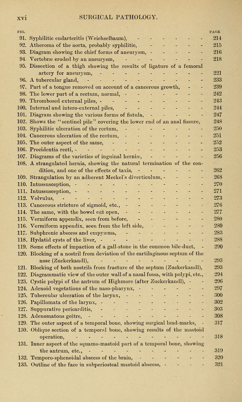 FIG. PAOE 91. Syphilitic endarteritis (Weichselbaum), 214 92. Atheroma of the aorta, probably syphilitic, .... - 215 93. Diagram showing the chief forms of aneurysm, ----- 216 94. Vertebras eroded by an aneurysm, - 218 95. Dissection of a thigh showing the results of ligatiire of a femoral artery for aneurysm, - 221 96. A tubercular gland, - 233 97. Part of a tongue removed on account of a cancerous growth, - - 239 98. The lower part of a rectum, normal, 242 99. Thrombosed external piles, 243 100. Internal and intero-external piles, 244 101. Diagram showing the various forms of fistula, 247 102. Shows the sentinel pile covering the lower end of an anal fissure, 248 103. Syphilitic ulceration of the rectum, 250 104. Cancerous ulceration of the rectum, - - - - - - - 251 105. The outer aspect of the same, - - 252 106. Procidentia recti, ----------- 253 107. Diagrams of the varieties of inguinal herniaj, 256 108. A strangulated hernia, showing the natural termination of the con- dition, and one of the effects of taxis, 262 109. Strangulation by an adherent Meckel's diverticulum, - - - - 268 110. Intussusception, . . . 270 111. Intussusception, -.. 271 112. Volvulus, 273 113. Cancerous stricture of sigmoid, etc., 276 114. The same, with the bowel cat open, 277 115. Vermiform appendix, seen from before, ------ 280 116. Vermiform appendix, seen from the left side, ----- 280 117. Subphrenic abscess and empyjema, 283 118. Hydatid cysts of the liver, 288 119. Some effects of impaction of a gall-stone in the common bile-duct, - 290 120. Blocking of a nostril from deviation of the cartilaginous septum of the nose (Zuckerkandl), 293 121. Blocking of both nostrils from fracture of the septum (Zuckerkandl), 293 122. Diagrammatic view of the outer wall of a nasal fossa, with polypi, etc., 294 123. Cystic polypi of the antrum of Highmore (after Zuckerkandl), - - 296 124. Adenoid vegetations of the naso-pharynx, 297 12-5. Tubercular ulceration of the larynx, 300 126. Papillomata of the larynx, 302 127. Suppurative pericarditis, 303 128. Adenomatous goitre, 308 129. The outer aspect of a temporal bone, showing surgical land-marks, - 317 130. Oblique section of a tempornl bone, showing results of the mastoid ojieration, -318 131. Inner aspect of the squamo-mastoid part of a temporal bone, showing the antrum, etc., 319 132. Temporo-sphenoidal abscess of the brain, ------ 320 13.3. Outline of the face in subperiosteal mastoid abscess, - - - - 321
