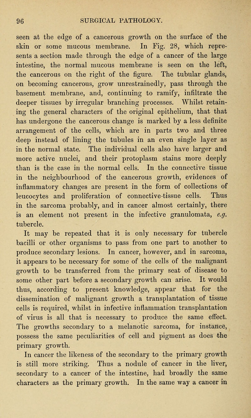 seen at the edge of a cancerous growth on the surface of the skin or some mucous membrane. In Fig. 28, which repre- sents a section made through the edge of a cancer of the large intestine, the normal mucous membrane is seen on the left, the cancerous on the right of the figure. The tubular glands, on becoming cancerous, grow unrestrainedly, pass through the basement membrane, and, continuing to ramify, infiltrate the deeper tissues by irregular branching processes. Whilst retain- ing the general characters of the original epithelium, that that has undergone the cancerous change is marked by a less definite arrangement of the cells, which are in parts two and three deep instead of lining the tubules in an even single layer as in the normal state. The individual cells also have larger and more active nuclei, and their protoplasm stains more deeply than is the case in the normal cells. In the connective tissue in the neighbourhood of the cancerous growth, evidences of inflammatory changes are present in the form of collections of leucocytes and proliferation of connective-tissue cells. Thus in the sarcoma probably, and in cancer almost certainly, there is an element not present in the infective granulomata, e.g. tubercle. It may be repeated that it is only necessary for tubercle bacilli or other organisms to pass from one part to another to produce secondary lesions. In cancer, however, and in sarcoma, it appears to be necessary for some of the cells of the malignant growth to be transferred from the primary seat of disease to some other part before a secondary growth can arise. It would thus, according to present knowledge, appear that for the dissemination of malignant growth a transplantation of tissue cells is required, whilst in infective inflammation transplantation of virus is all that is necessary to produce the same effect. The growths secondary to a melanotic sarcoma, for instaiice, possess the same peculiarities of cell and pigment as does the primary growth. In cancer the likeness of the secondary to the primary growth is still more striking. Thus a nodule of cancer in the liver, secondary to a cancer of the intestine, had broadly the same characters as the primary growth. In the same way a cancer in