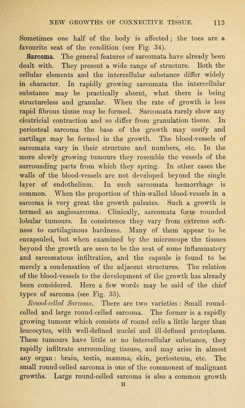 Sometimes one half of the body is affected; the toes are a favourite seat of the condition (see Fig. 34). Sarcoma. The general features of sarcomata have already been dealt with. They present a wide range of structure. Both the cellular elements and the intercellular substance differ widely in character. In rapidly growing sarcomata the intercellular substance may be practically absent, what there is being structureless and granular. When the rate of growth is less rapid fibrous tissue may be formed. Sarcomata rarely show any cicatricial contraction and so differ from granulation tissue. In periosteal sarcoma the base of the growth may ossify and cartilage may be formed in the growth. The blood-vessels of sarcomata vary in their structure and numbers, etc. In the more slowly growing tumours they resemble the vessels of the surrounding parts from which they spring. In other cases the walls of the blood-vessels are not developed beyond the single layer of endothelium. In such sarcomata haemorrhage is common. When the proportion of thin-walled blood-vessels in a sarcoma is very great the growth pulsates. Such a growth is termed an angiosarcoma. Clinically, sarcomata form rounded lobular tumours. In consistence they vary from extreme soft- ness to cartilaginous hardness. Many of them appear to be encapsuled, but when examined by the microscope the tissues beyond the growth are seen to be the seat of some inflammatory and sarcomatous infiltration, and the capsule is found to be merely a condensation of the adjacent structures. The relation of the blood-vessels to the development of the growth has already been considered. Here a few words may be said of the chief types of sarcoma (see Fig. 35). Round-celled Sarcoma. There are two varieties : Small round- celled and large round-celled sarcoma. The former is a rapidly growing tumour which consists of round cells a little larger than leucocytes, with well-defined nuclei and ill-defined protoplasm. These tumours have little or no intercellular substance, they rapidly infiltrate surrounding tissues, and may arise in almost any organ: brain, testis, mamma, skin, periosteum, etc. The small round-celled sarcoma is one of the commonest of malignant growths. Large round-celled sarcoma is also a common growth H