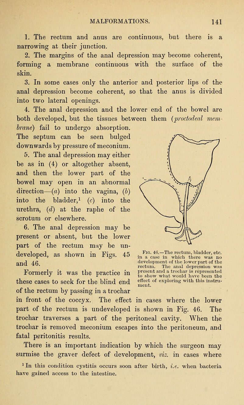 1. The rectum and anus are continuous, but there is a narrowing at their junction. 2. The margins of the anal depression may become coherent, forming a membrane continuous with the surface of the skin. 3. In some cases only the anterior and posterior lips of the anal depression become coherent, so that the anus is divided into two lateral openings. 4. The anal depression and the lower end of the bowel are both developed, but the tissues between them (proctodeal mem- brane) fail to undergo absorption. The septum can be seen bulged downwards by pressure of meconium. 6. The anal depression may either be as in (4) or altogether absent, and then the lower part of the bowel may open in an abnormal direction—(a) into the vagina, (b) into the bladder,^ (c) into the urethi'a, (d) at the raphe of the scrotum or elsewhere. 6. The anal depression may be present or absent, but the lower part of the rectum may be un- developed, as shown in Figs. 45 and 46. Formerly it was the practice in these cases to seek for the blind end of the rectum by passing in a trochar in front of the coccyx. The effect in cases where the lower part of the rectum is undeveloped is shown in Fig. 46. The trochar traverses a part of the peritoneal cavity. When the trochar is removed meconium escapes into the peritoneum, and fatal peritonitis results. There is an important indication by which the surgeon may surmise the graver defect of development, viz. in cases where 1 In this condition cystitis occurs soon after birth, i.e. when bacteria have gained access to the intestine. Fig. 46.—The rectum, bladder, etc. in a case in which there was no development of the lower part of the rectum. The anal depression was present and a trochar is represented to show what would have been the effect of exploring with this instru- ment.