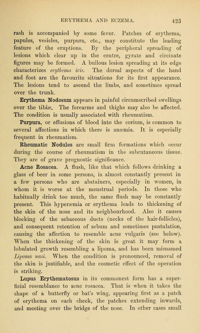 rash is accompanied by some fever. Patches of erythema, papules, vesicles, purpura, etc., may constitute the leading feature of the eruptions. By the peripheral spreading of lesions which clear up in the centre, gyrate and circiuate figures may be formed. A bullous lesion spreading at its edge characterizes erythema iris. The dorsal aspects of the hand and foot are the favourite situations for its first appearance. The lesions tend to ascend the limbs, and sometimes spread over the trunk. Erythema Nodosum appears in painful circumscribed swellings over the tibiae. The forearms and thighs may also be aff'ected. The condition is usually associated with rheumatism. Purpura, or effusions of blood into the corium, is common to several affections in which there is anaemia. It is especially frequent in rheumatism. Rheumatic Nodules are small firm formations which occur during the course of rheumatism in the subcutaneous tissue. They are of grave prognostic significance. Acne Rosacea. A flush, like that which follows drinking a glass of beer in some persons, is almost constantly present in a few persons who are abstainers, especially in women, in whom it is worse at the menstrual periods. In those who habitually drink too much, the same flush may be constantlj^ present. This hyperaemia or erythema leads to thickening of the skin of the nose and its neighbourhood. Also it causes blocking of the sebaceous ducts (necks of the hair-follicles), and consequent retention of sebum and sometimes pustulation, causing the affection to resemble acne vulgaris (see below). When the thickening of the skin is great it may form a lobulated growth resembling a lipoma, and has been misnamed Lipoma nasi. When the condition is pronounced, removal of the skin is justifiable, and the cosmetic effect of the operation is striking. Lupus Erythematosus in its commonest form has a super- ficial resemblance to acne rosacea. That is when it takes the shape of a butterfly or bat's wing, appearing first as a patch of erythema on each cheek, the patches extending inwards, and meeting over the bridge of the nose. In other cases small