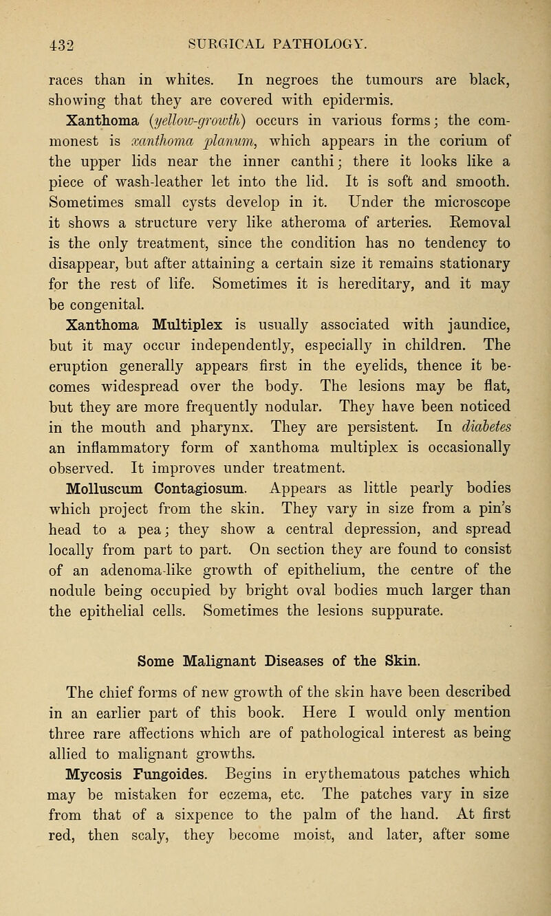 races than in whites. In negroes the tumours are black, showing that they are covered with epidermis. Xanthoma {yellow-growth) occurs in various forms; the com- monest is xanthoma planum, which appears in the corium of the upper lids near the inner canthi; there it looks like a piece of wash-leather let into the lid. It is soft and smooth. Sometimes small cysts develop in it. Under the microscope it shows a structure very like atheroma of arteries. Removal is the only treatment, since the condition has no tendency to disappear, but after attaining a certain size it remains stationary for the rest of life. Sometimes it is hereditary, and it may be congenital. Xanthoma Multiplex is usually associated with jaundice, but it may occur independently, especially in children. The eruption generally appears first in the eyelids, thence it be- comes widespread over the body. The lesions may be flat, but they are more frequently nodular. They have been noticed in the mouth and pharynx. They are persistent. In diabetes an inflammatory form of xanthoma multiplex is occasionally observed. It improves under treatment. MoUuscum Contagiosum. Appears as little pearly bodies which project from the skin. They vary in size from a pin's head to a pea; they show a central depression, and spread locally from part to part. On section they are found to consist of an adenoma-like growth of epithelium, the centre of the nodule being occupied by bright oval bodies much larger than the epithelial cells. Sometimes the lesions suppurate. Some Malignant Diseases of the Skin. The chief forms of new growth of the skin have been described in an earlier part of this book. Here I would only mention three rare affections which are of pathological interest as being allied to malignant growths. Mycosis Fungoides. Begins in erythematous patches which may be mistaken for eczema, etc. The patches vary in size from that of a sixpence to the palm of the hand. At first red, then scaly, they become moist, and later, after some