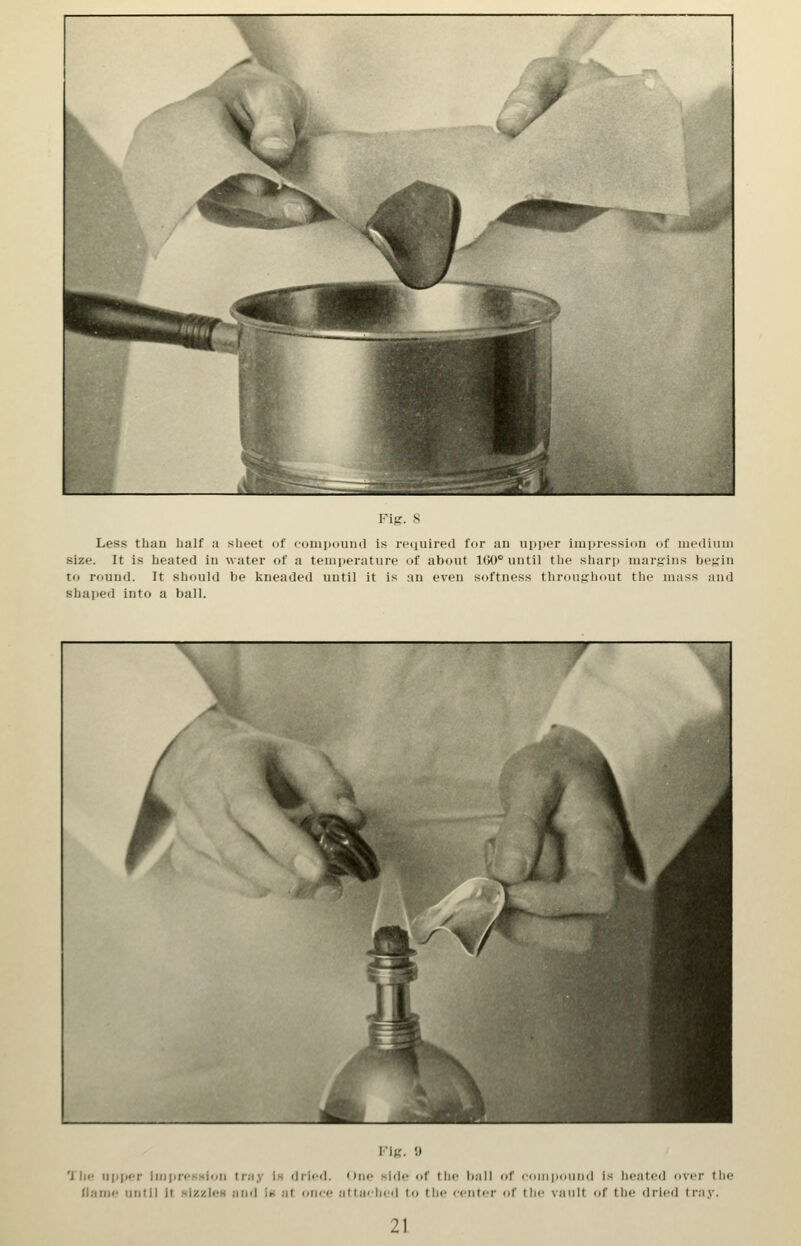 Less than half a sheet of (•onipound is reciuired for an upper impression of niedluni size. It is heated in water of a temperature of about 160° until the sharp margins be^'in to round. It should be kneaded until it is an even softness throughout the mass and shaped into a ball. rig. ;• 'JIh! upper ImpreKsioii tray Is dried. One siih- of the ball of ciiiripipiiiid is heated over the flame until It hIz/Jch uikI Im at onee attached to the citiiU-i- of the vault of the drii^d tray.