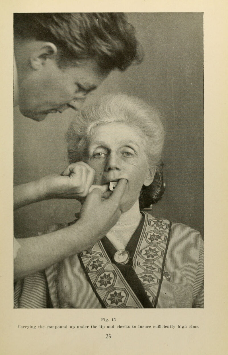 ('iin-y\lii; tlio coiiiiioiiimI ii|< iiiiilci- tln' lip nnd rlicck.s to iiism-c siillicifiilly lii;,Mi rims.