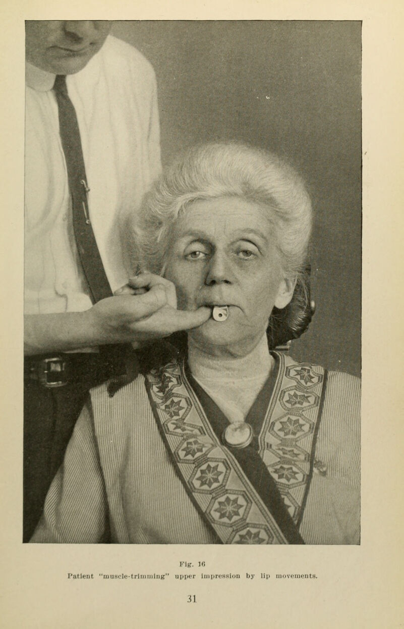 Patient musck'-trlriiinliiK upper imprcssiDii by Hi) iiiovciiH.'iits.