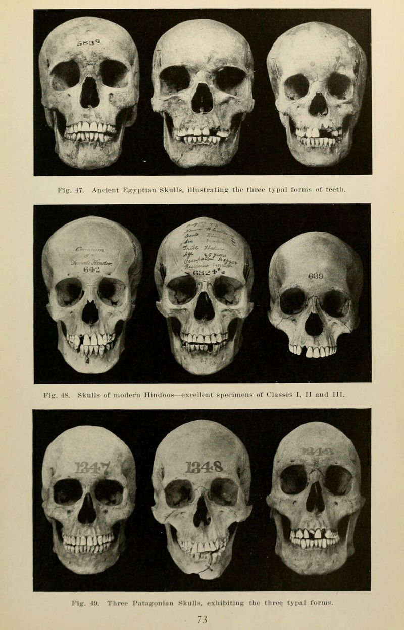 Fig. 4. Ancient Egyptian Skulls, illustrating the three typal furms of teeth.