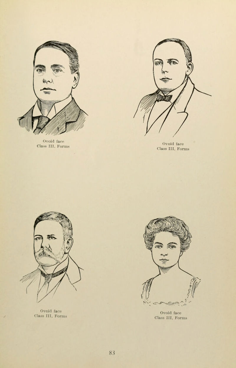 Ovoid face Class III, Forms Ovoid face Class III, Forms Ovoid face Class III, Forms Ovoid face Class HI, Forms