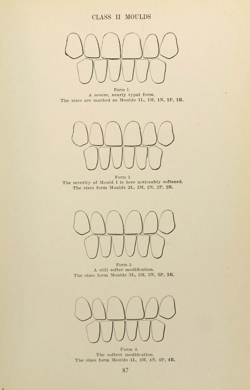Form 1. A severe, nearly typal form. The sizes are marked as Moulds IL, IM, IN, IP, IR. Form 2. The severity of Mould 1 is here noticeably softened. The sizes form Moulds 2L, 2M, 2N, 2P, 2R. Form 3. A still softer modification. The sizes form Moulds 3L, 3M, 3N, 3P, 3R. Form 1. The softest modification. The sizes form Moulds 4L, 4.VI, 4N, 4P, 4R.