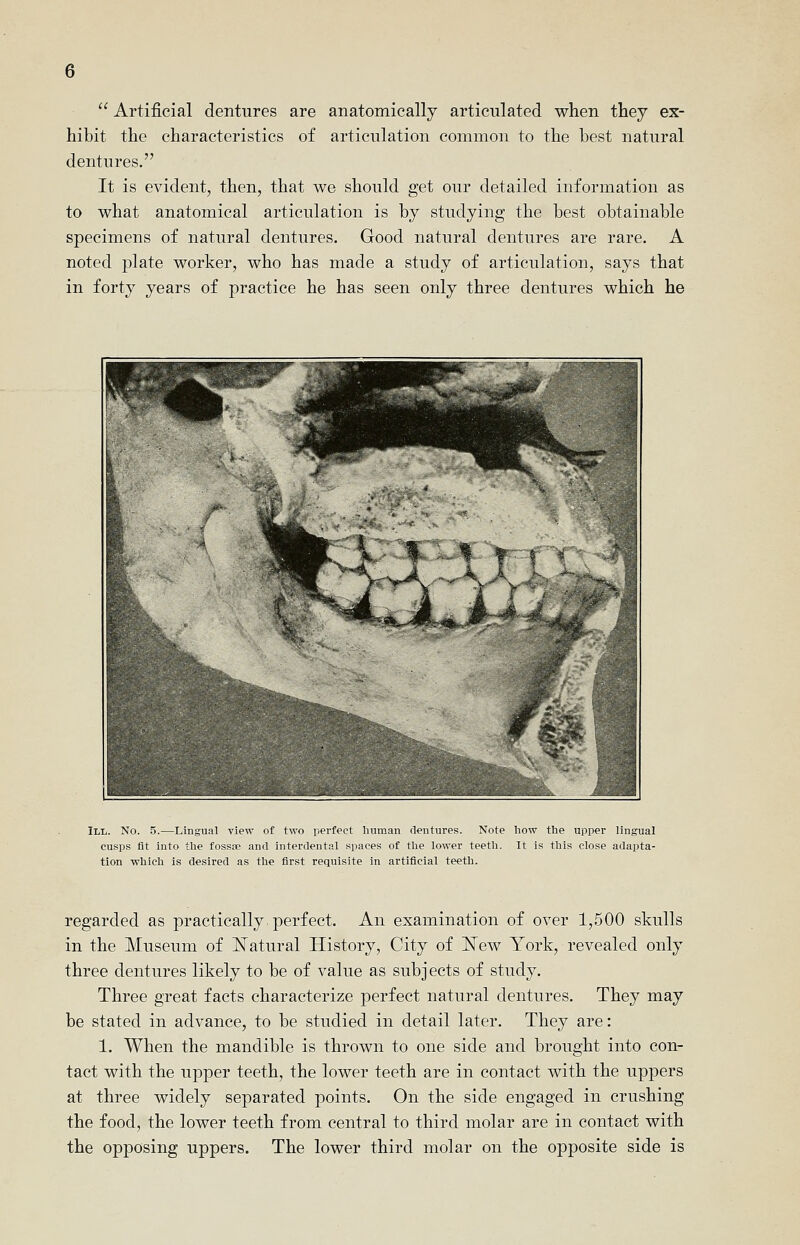 Artificial dentures are anatomically articulated when they ex- hibit the characteristics of articulation common to the best natural dentures. It is evident, then, that we should get our detailed information as to what anatomical articulation is by studying the best obtainable specimens of natural dentures. Good natural dentures are rare. A noted plate worker, who has made a study of articulation, says that in forty years of practice he has seen only three dentures which he III. No. 5.—Lingual view of two perfect human dentures. Note how the upper lingual cusps fit into the fossce and interdental spaces of the lower teeth. It Is this close adapta- tion which is desired as the first requisite in artificial teeth. regarded as practically, perfect. An examination of over 1,500 skulls in the Museum of ISTatural History, City of 'New York, revealed only three dentures likely to be of value as subjects of study. Three great facts characterize perfect natural dentures. They may be stated in advance, to be studied in detail later. They are: 1. When the mandible is thrown to one side and brought into con- tact with the upper teeth, the lower teeth are in contact with the uppers at three widely separated points. On the side engaged in crushing the food, the lower teeth from central to third molar are in contact with the opposing uppers. The lower third molar on the opposite side is