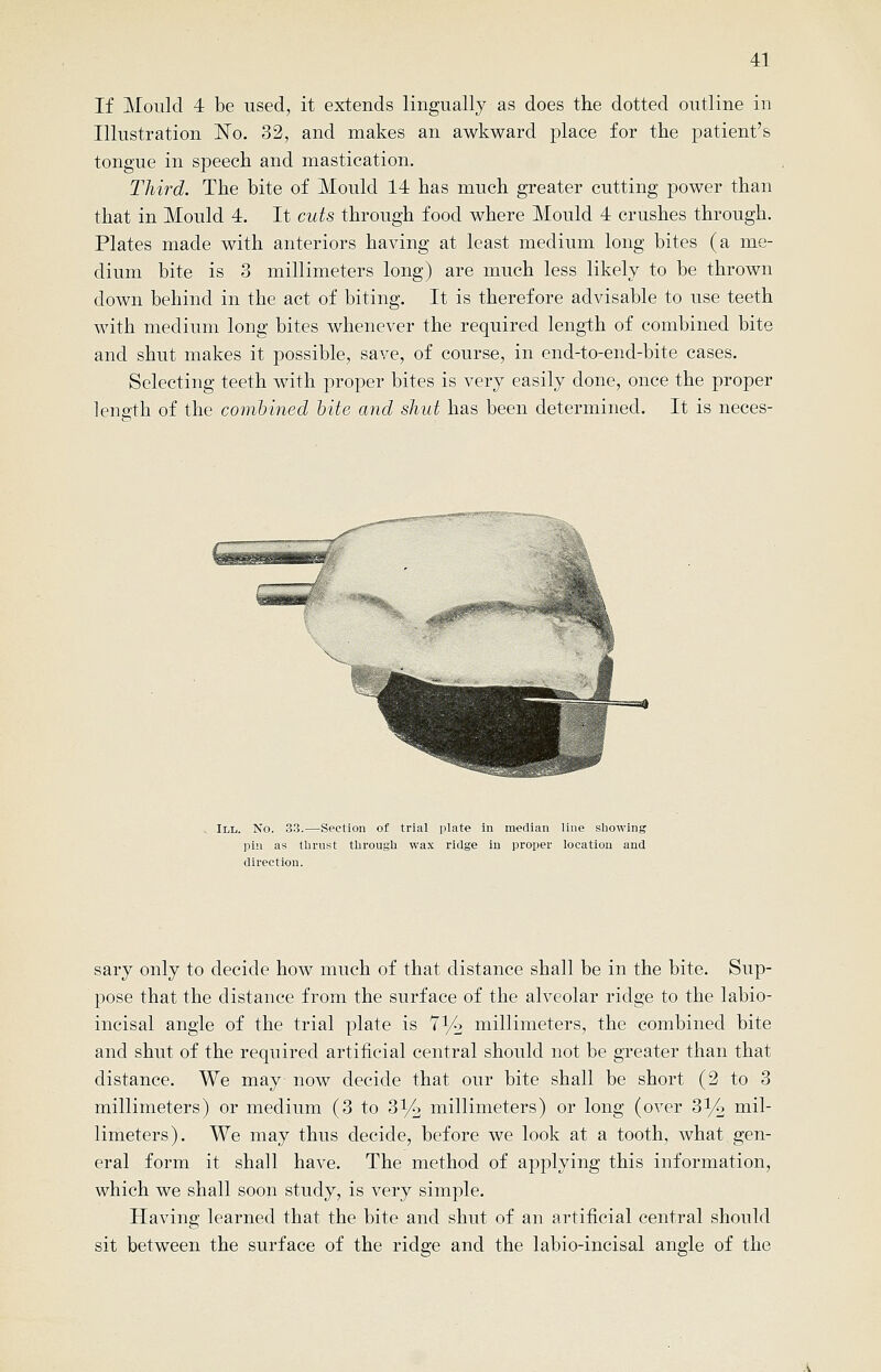 If Mould 4 be used, it extends lingually as does the dotted outline in Illustration 'No. 32, and makes an awkward place for the patient's tongue in speech and mastication. Third. The bite of Mould 14 has much greater cutting power than that in Mould 4. It cuts through food where Mould 4 crushes through. Plates made with anteriors having at least medium long bites (a me- dium bite is 3 millimeters long) are much less likely to be thrown down behind in the act of biting. It is therefore advisable to use teeth with medium long bites whenever the required length of combined bite and shut makes it possible, save, of course, in end-to-end-bite cases. Selecting teeth with proper bites is very easily done, once the proper length of the combined bite and shut has been determined. It is neces- ILL. No. 33.—Section of trial plate in median line showing pin as llirnst through wax ridge in proper location and direction. sary only to decide how much of that distance shall be in the bite. Sup- pose that the distance from the surface of the alveolar ridge to the labio- incisal angle of the trial plate is 7^2 millimeters, the combined bite and shut of the required artificial central should not be greater than that distance. We may now decide that our bite shall be short (2 to 3 millimeters) or medium (3 to 31/2 millimeters) or long (over 31/2 mil- limeters). We may thus decide, before we look at a tooth, what gen- eral form it shall have. The method of applying this information, which we shall soon study, is very simple. Having learned that the bite and shut of an artificial central should sit between the surface of the ridge and the labio-incisal angle of the