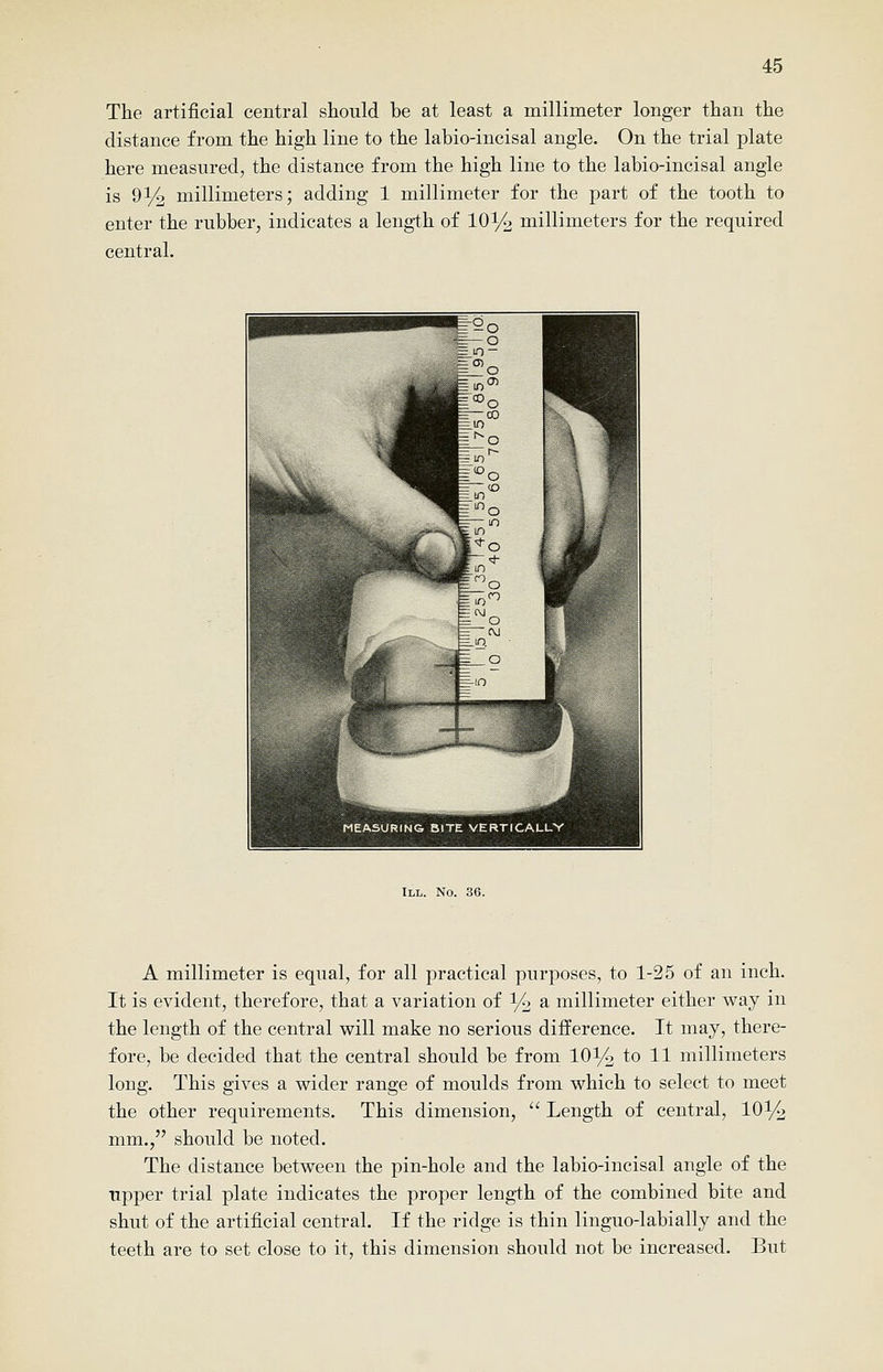 The artificial central should be at least a millimeter longer than the distance from the high line to the labio-incisal angle. On the trial plate here measured, the distance from the high line to the labio-incisal angle is 9% millimeters; adding 1 millimeter for the part of the tooth to enter the rubber, indicates a length of 10^ millimeters for the required central. III. No. 36. A millimeter is equal, for all practical purposes, to 1-25 of an inch. It is evident, therefore, that a variation of I/2 a millimeter either way in the length of the central will make no serious difference. It may, there- fore, be decided that the central should be from 101/4 to 11 millimeters long. This gives a wider range of moulds from which to select to meet the other requirements. This dimension,  Length of central, lO^/o mm., should be noted. The distance between the pin-hole and the labio-incisal angle of the upper trial plate indicates the proper length of the combined bite and shut of the artificial central. If the ridge is thin linguo-labially and the teeth are to set close to it, this dimension should not be increased. But