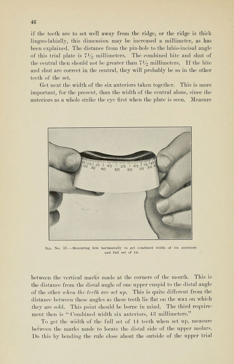 if the teeth are to set well away from the ridge, or the ridge is thick linguo-labially, this dimension may be increased a millimeter, as has been explained. The distance from the pin-hole to the labio-incisal angle of this trial plate is T^/^ millimeters. The combined bite and shut of the central then should not be greater than 7i/o millimeters. If the bite and shut are correct in the central, they will probably be so in the other teeth of the set. Get next the width of the six anteriors taken together. This is more important, for the present, than the width of the central alone, since the anteriors as a whole strike the eye first when the plate is seen. Measure III. No. 37.—Measuring bite horizontally to get combined width of six anteriors and full set of 14. between the vertical marks made at the corners of the mouth. This is the distance from the distal angle of one upper cuspid to the distal angle of the other ivlien the teeth are set up. This is quite different from the distance between these angles as these teeth lie flat on the wax on which they are sold. This point should be borne in mind. The third require- ment then is  Combined width six anteriors, 43 millimeters. To get the width of the full set of 14 teeth when set up, measure between the marks made to locate the distal side of the upper molars. Do this by bending the rule close about the outside of the upper trial