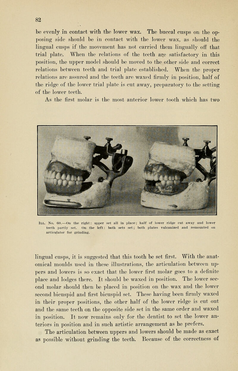 be evenly in contact with the lower wax. The buccal cusps on the op- posing side should be in contact with the lower wax, as should the lingual cusps if the movement has not carried them lingually off that trial plate. When the relations of the teeth arie satisfactory in this position, the upper model should be moved to the other side and correct relations between teeth and trial plate established. When the proper relations are assured and the teeth are waxed firmly in position, half of the ridge of the lower trial plate is cut away, preparatory to the setting of the lower teeth. As the first molar is the most anterior lower tooth which has two III. No. 60.—On the right: upper set all in place; half of lower ridge cut away and lower teeth partly set. On the left: both sets set; both plates vulcanized and remounted on articulator for grinding. lingual cusps, it is suggested that this tooth be set first. With the anat- omical moulds used in these illustrations, the articulation between up- pers and lowers is so exact that the lower first molar goes to a definite place and lodges there. It should be waxed in position. The lower sec- ond molar should then be placed in position on the wax and the lower second bicuspid and first bicuspid set. These having been firmly waxed in their proper positions, the other half of the lower ridge is cut out and the same teeth on the opposite side set in the same order and waxed in position. It now remains only for the dentist to set the lower an- teriors in position and in such artistic arrangement as he prefers. The articulation between uppers and lowers should be made as exact as possible without grinding the teeth. Because of the correctness of