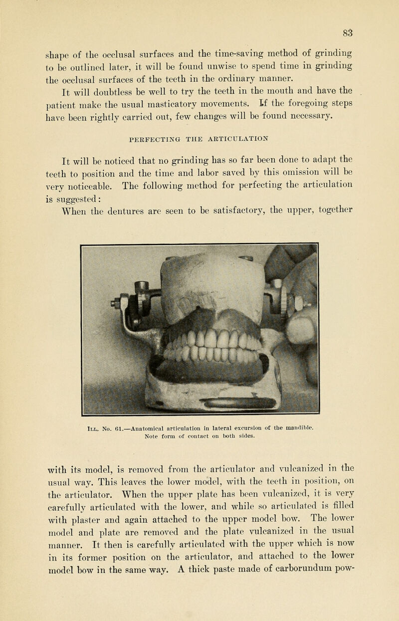 shape of the occlusal surfaces and the time-saving method of grinding to be outlined later, it will be found unwise to spend time in grinding the occlusal surfaces of the teeth in the ordinary manner. It will doubtless be well to try the teeth in the mouth and have the patient make the usual masticatory movements. If the foregoing steps have been rightly carried out, few changes will be found necessary. PERFECTING THE ARTICULATION It will be noticed that no grinding has so far been done to adapt the teeth to position and the time and labor saved by this omission will be very noticeable. The following method for perfecting the articulation is suggested: When the dentures are seen to be satisfactory, the upper, together III. No. CI.—Anatomical articulation in lateral excursion of tbe mandible. Note form of contact on lK)th sides. with its model, is removed from the articulator and vulcanized in the usual way. This leaves the lower model, with the teeth in position, on the articulator. When the upper plate has been vulcanized, it is very carefully articulated with the lower, and while so articulated is filled with plaster and again attached to the upper model bow. The lower model and plate are removed and the plate vulcanized in the usual manner. It then is carefully articulated with the upper which is now in its former position on the articulator, and attached to the lower model bow in the same way. A thick paste made of carborundum pow-
