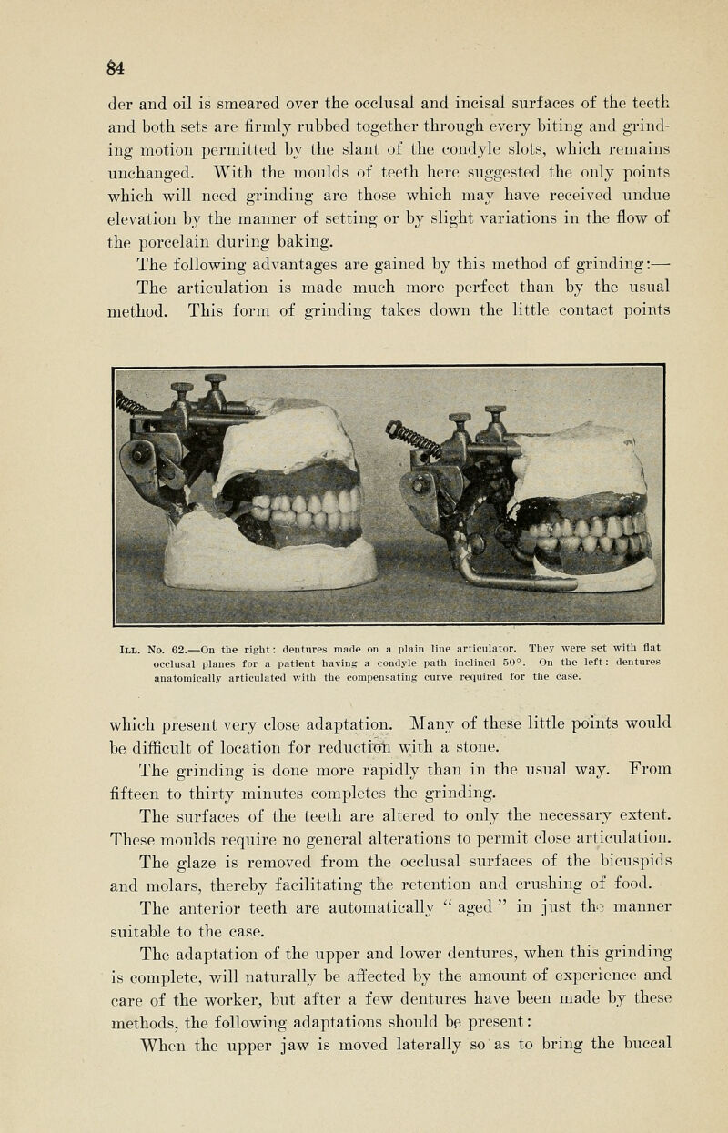 §4 der and oil is smeared over the occlusal and incisal surfaces of the teeth and both sets are firmly rubbed together through every biting and grind- ing motion permitted by the slant of the condyle slots, which remains unchanged. With the moulds of teeth here suggested the only points which will need grinding are those which may have received undue elevation by the manner of setting or by slight variations in the flow of the porcelain during baking. The following advantages are gained by this method of grinding:— The articulation is made much more perfect than by the usual method. This form of gTinding takes down the little contact points III. No. 62.—On the right: dentures made on a plain line articulator. They were set with flat occlusal planes for a patient having a condyle path inclined 50°. On the left: dentures anatomically articulated with the compensating curve required for the case. which present very close adaptation. Many of these little points would be difficult of location for reducti'dn with a stone. The grinding is done more rapidly than in the usual way. From fifteen to thirty minutes completes the grinding. The surfaces of the teeth are altered to only the necessary extent. These moulds require no general alterations to permit close articulation. The glaze is removed from the occlusal surfaces of the bicuspids and molars, thereby facilitating the retention and crushing of food. The anterior teeth are automatically  aged  in just tbj manner suitable to the case. The adaptation of the upper and lower dentures, when this grinding is complete, will naturally be afi'ected by the amount of experience and care of the worker, but after a few dentures have been made by these methods, the following adaptations should be present: When the upper jaw is moved laterally so as to bring the buccal