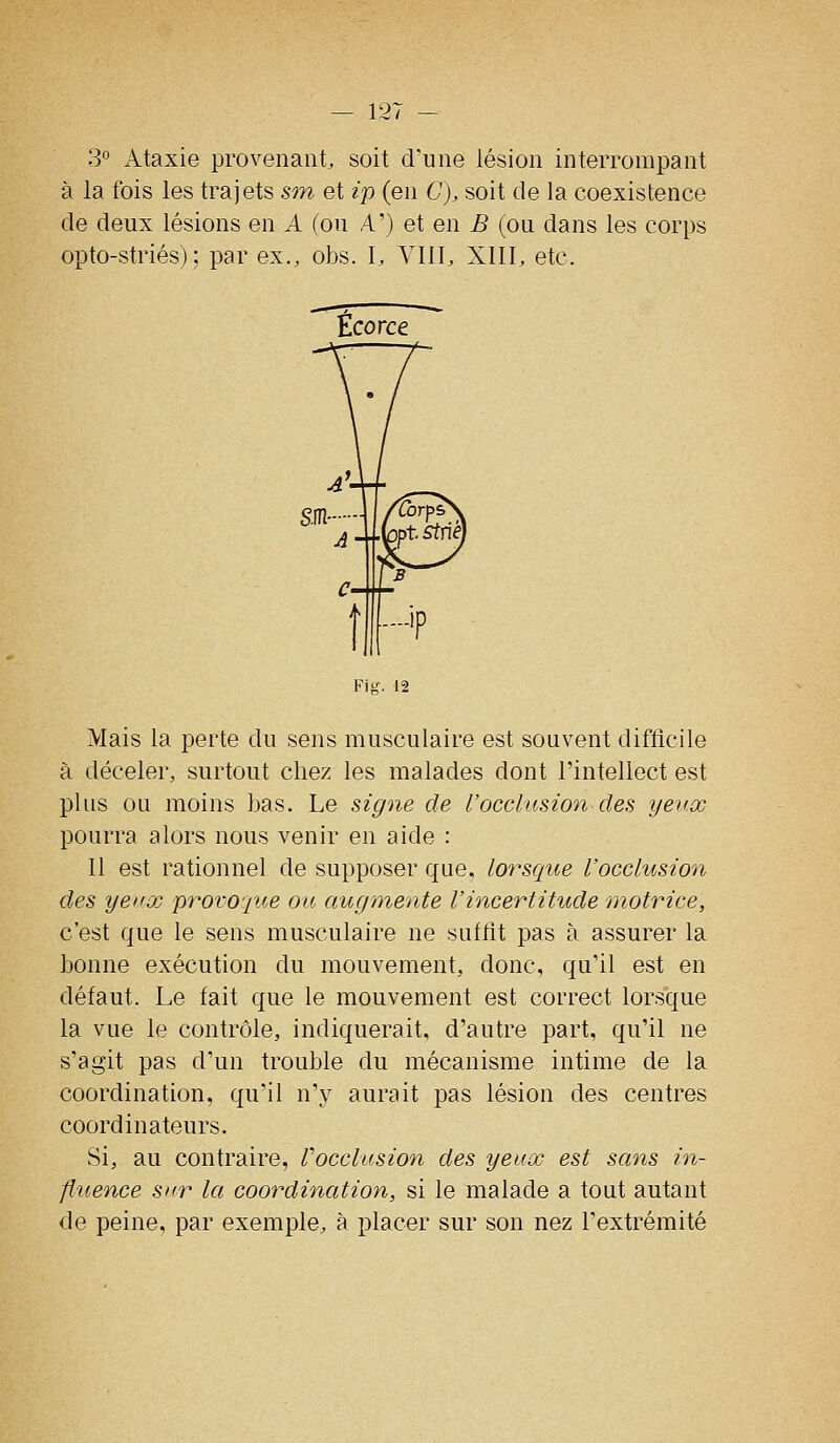 3° Ataxie provenant, soit d'une lésion interrompant à la fois les trajets sw et ïp (en C), soit de la coexistence de deux lésions en A (ou A') et en B (ou dans les corps opto-striés) ; par ex., obs. L YllI, XIII, etc. Fii?. 12 Mais la perte du sens musculaire est souvent difficile à déceler, surtout chez les malades dont l'intellect est plus ou moins Las. Le signe de l'occlusion des yeux pourra alors nous venir en aide : Il est rationnel de supposer que, lorsque l'occlusion des yeux provoque ou augmente l'incertitude motrice, c'est que le sens musculaire ne suffit pas à assurer la bonne exécution du mouvement, donc, qu'il est en défaut. Le fait que le mouvement est correct lorsque la vue le contrôle, indiquerait, d'autre part, qu'il ne s'agit pas d'un trouble du mécanisme intime de la coordination, qu'il n'y aurait pas lésion des centres coordinateurs. Si, au contraire, Vocclusion des yeux est sans in- fluence sur la coordination, si le malade a tout autant de peine, par exemple, à placer sur son nez l'extrémité