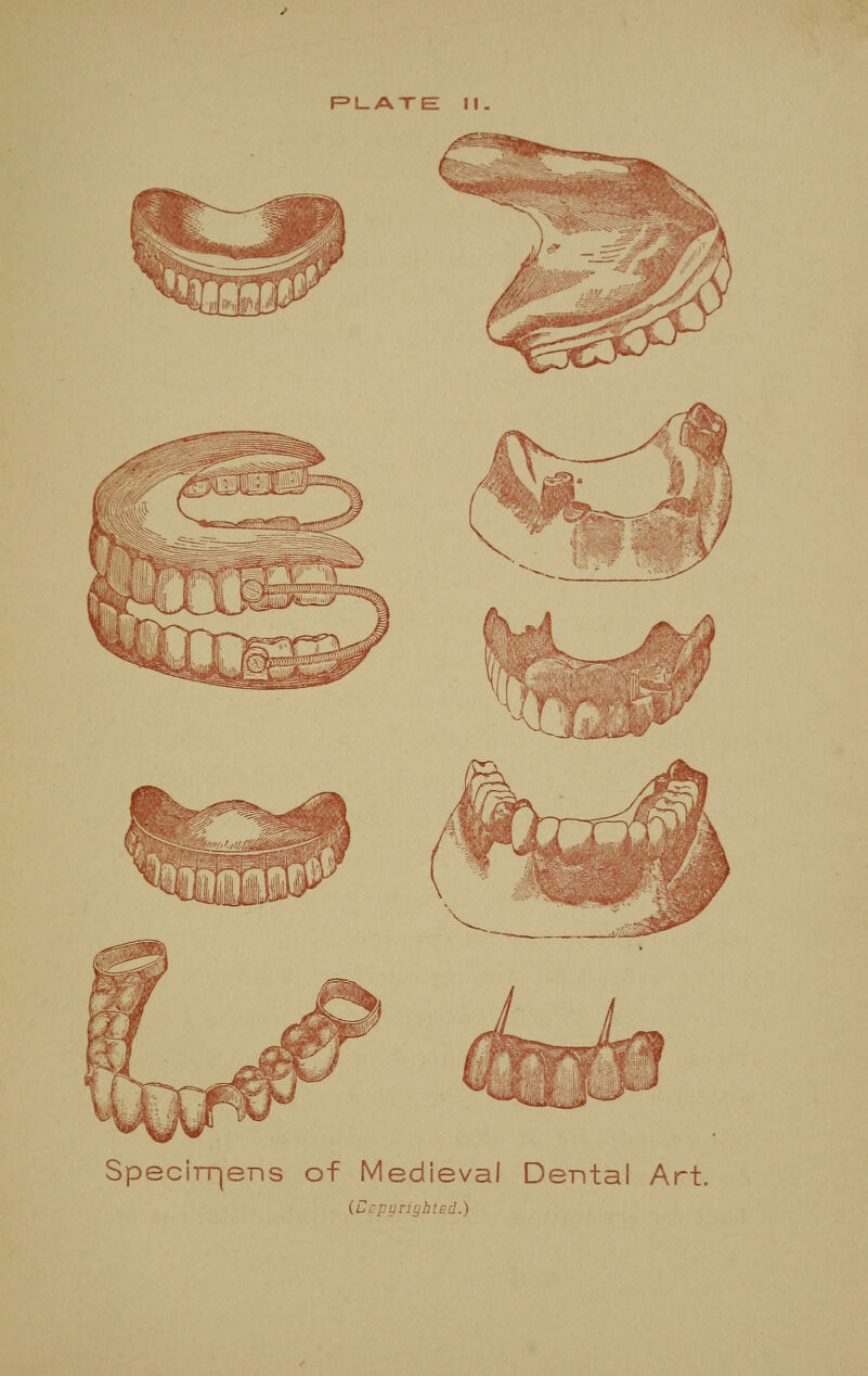 Specirqens of Medieval Dental Art. (OcpynghtEd.)