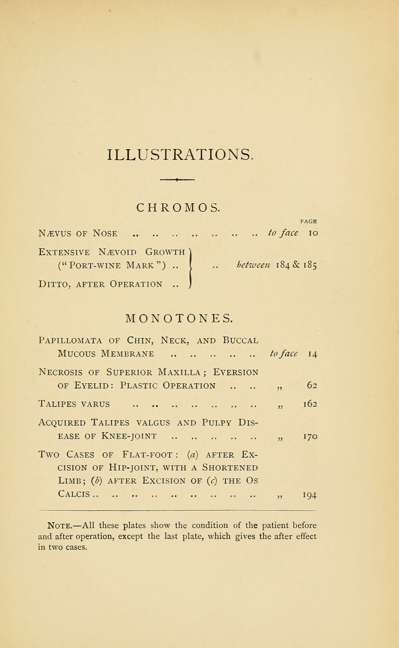 ILLUSTRATIONS. C H R O M O S. PAGE NiEVUS OF Nose to face \o Extensive N^evoid Growth \ (Port-wine Mark) .. I ,. between 184& 185 Ditto, after Operation .. ) MONOTONES. Papillomata of Chin, Neck, and Buccal Mucous Membrane to face 14 Necrosis of Superior Maxilla ; Eversion OF Eyelid: Plastic Operation ,. ,, „ 62 Talipes varus .. .. .. .. „ 162 Acquired Talipes valgus and Pulpy Dis- ease of Knee-joint „ 170 Two Cases of Flat-foot : {a) after Ex- cision of Hip-joint, with a Shortened Limb; {b) after Excision of {c) the Os Calcis „ 194 Note.—All these plates show the condition of the patient before and after operation, except the last plate, which gives the after effect in two cases.