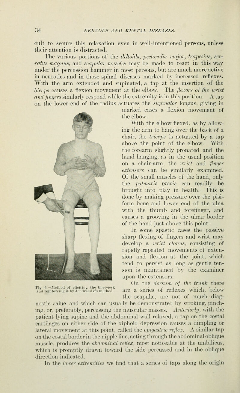 cult to secure this relaxation even in well-intentioned persons, unless their atteution is distracted. The various portions of the deltoids, pecforalis major, trapezius, ser- rcdus magnus, and scapular muscles may be made to react in this way under the percussion hammer in most persons, but are much more active in neurotics and in those spinal diseases marked by increased reflexes. With the arm extended and supinated, a tap at the insertion of the biceps causes a flexion movement at the elbow. The flexors of the wrist and flngers similarly respond while the extremity is in this position. A tap on the lower end of the radius actuates the supinator longus, giving in marked cases a flexion movement of the elbow. With the elbow flexed, as by allow- ing the arm to hang over the back of a chair, the triceps is actuated b} a tap above the point of the elbow. With the forearm slightly pronated and the hand hanging, as in the usual position on a chair-arm, the icrist and finger extensors can be similarly examined. Of the small muscles of the hand, only the pcdmaris hrevis can readily be brought into play in health. This is done by making pressure over the pisi- form bone and lower end of the ulna with the thumb and forefinger, and causes a grooving in the ulnar border of the hand just above this point. In some spastic cases the passive sharp flexing of fingers and ^Tist may develop a ivrist clonus, consisting of rapidly repeated movements of exten- sion and flexion at the joint, which tend to persist as long as gentle ten- sion is maintained by the examiner upon the extensors. On the dorsum of the trunk there are a series of reflexes which, below the scapulae, are not of much diag- nostic value, and which can usually be demonstrated by stroking, pinch- ing, or, preferably, percussing the muscular masses. Anteriorly, \\-ith the patient lying supine and the abdominal wall relaxed, a tap on the costal cartilages on either side of the xiphoid depression causes a dimpUng or lateral movement at this point, called the epigastric reflex. A similar tap on the costal border in the nipple line, acting through the abdominal oblique muscle, produces the abdominal reflex, most noticeable at the umbilicus, which is promptly drawn toward the side percussed and in the oblique direction indicated. In the lower extremities we find that a series of taps along the origin r A Fig. 6.—Method of eliciting the knee-jerk and reinforcing it by Jeudrassik's method.