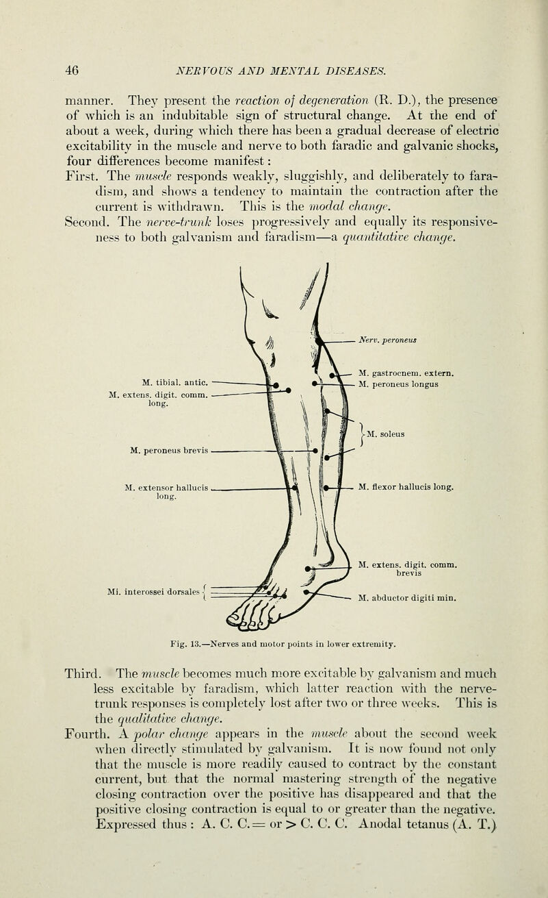 manner. They present the reaction of degeneration (R. D.), the presence of which is an indubitable sign of structural change. At the end of about a week, during which there has been a gradual decrease of electric excitability in the muscle and nerve to both faradic and galvanic shocks, four differences become manifest: First. The muscle responds weakly, sluggishly, and deliberately to fara- dism, and shows a tendency to maintain the contraction after the current is withdrawn. This is the modal change. Second. The nerve-trunk loses progressively and equally its responsive- ness to both galvanism and faradism—a quantitative change. M. tibial, antic. M. extens. digit, comm. long. M. peroneus brevis M. extensor hallucis long. Mi. interossei dorsales ] Nerv. peroneus M. gastrocnem. extern. M. peroneus longus M. soleus M. flexor hallucis long. M. extens. digit, comm. brevis M. abductor digiti min. Fig. 13.—Nerves and motor points in lower extremity. Third. The muscle becomes much more excitable by galvanism and much less excitable by faradism, which latter reaction with the nerve- trunk responses is completely lost after two or three weeks. This is the qualitative change. Fourth. A polar change appears in the muscle about the second week when directly stimulated by galvanism. It is now found not only that the muscle is more readily caused to contract by the constant current, but that the normal mastering strength of the negative closing contraction over the positive has disappeared and that the positive closing contraction is equal to or greater than the negative. Expressed thus : A. C. C. = or > C. C. C. Anodal tetanus (A. T.)