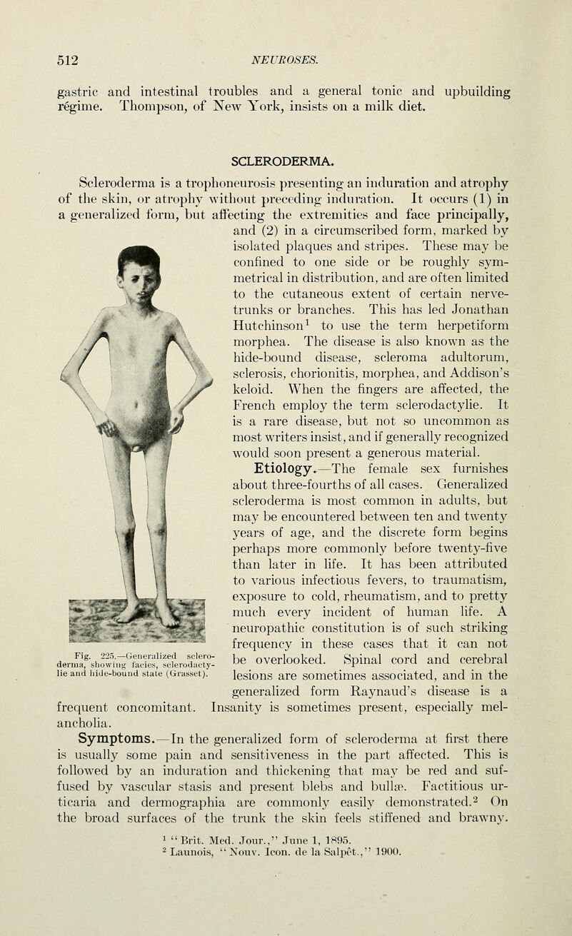 gastric and intestinal troubles and a general tonic and upbuilding regime. Thompson, of New York, insists on a milk diet. SCLERODERMA. Scleroderma is a trophoneurosis presenting an induration and atrophy of the skin, or atrophy without preceding induration. It occurs (1) in a generalized form, but affecting the extremities and face principally, and (2) in a circumscribed form, marked by isolated plaques and stripes. These may be confined to one side or be roughly sym- metrical in distribution, and are often limited to the cutaneous extent of certain nerve- trunks or branches. This has led Jonathan Hutchinson^ to use the term herpetiform morphea. The disease is also known as the hide-bound disease, scleroma adultorum, sclerosis, chorionitis, morphea, and Addison's keloid. When the fingers are affected, the French employ the term sclerodactylie. It is a rare disease, but not so uncommon as most writers insist, and if generally recognized would soon present a generous material. Etiology..—The female sex furnishes about three-fourths of all cases. Generalized scleroderma is most common in adults,.but may be encountered between ten and twenty years of age, and the discrete form begins perhaps more commonly before twenty-five than later in life. It has been attributed to various infectious fevers, to traumatism, exposure to cold, rheumatism, and to pretty much every incident of human life. A neuropathic constitution is of such striking frequency in these cases that it can not be overlooked. Spinal cord and cerebral lesions are sometimes associated, and in the generalized form Raynaud's disease is a frequent concomitant. Insanity is sometimes present, especially mel- ancholia. Symptoms.—In the generalized form of scleroderma at first there is usually some pain and sensitiveness in the part affected. This is followed by an induration and thickening that may be red and suf- fused by vascular stasis and present blebs and bulla^. Factitious ur- ticaria and dermographia are commonly easily demonstrated.'^ On the broad surfaces of the trunk the skin feels stiffened and brawny- Fig. 225.—Geueriilized sclero- derma, showing I'acies, sclerodacty- lie and liide-bouud state (Grasset). 1 Brit. Med. Jour., June 1, 1895. ^ Launoi.s,  Nouv. Icon, cle la Salpet., 1900.