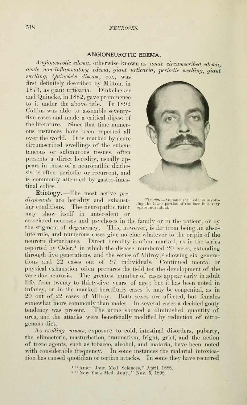 ANGIONEUROTIC EDEMA. Angioneurotic edema, otherwise known as acute circums&'ibed edema, acute non-inflammatory edema, giant urticana, penodic sivelling, giant swelling, Quincke's disease, etc., was first definitelv described by Milton, in 1876, as giant urticaria. Dinkelacker and Quincke, in 1882, gave prominence to it under the above title. In 1892 Collins w^as able to assemble seventy- five cases and made a critical digest of the literature. Since that time numer- ous instances have been reported all over the world. It is marked by acute circumscribed swellings of the subcu- taneous or submucous tissues, often presents a direct heredity, usually ap- pears in those of a neuropathic diathe- sis, is often periodic or recurrent, and is commonly attended by gastro-intes- tinal colics. Etiology.—The most active pre- disposants are heredit}^ and exhaust- ing conditions. The neuropathic taint may show itself in antecedent or associated neuroses and psychoses in the family or in the patient, or by the stigmata of degeneracy. This, however, is far from being an abso- lute rule, and numerous cases give no clue -whatever to the origin of the neurotic disturbance. Direct heredity is often marked, as in the series reported by Osier, ^ in which the disease numbered 20 cases, extending through five generations, and the series of Milroy,^ showing six genera- tions and 22 cases out of 97 individuals. Continued mental or physical exhaustion often prepares the field for the development of the vascular neurosis. The greatest number of cases appear early in adult life, from twenty to thirty-five years of age; but it has been noted in infancy, or in the marked hereditary cases it may be congenital, as in 20 out of 22 cases of ^Slilroy. Both sexes are affected, but females somewhat more commonly than males. In several cases a decided gouty tendency was present. The urine showed a diminished quantity of urea, and the attacks were beneficially modified by reduction of nitro- genous diet. As exciting causes, exposure to cold, intestinal disorders, puberty, the climacteric, masturbation, traumatism, fright, grief, and the action of toxic agents, such as tobacco, alcohol, and malaria, have been noted with considerable frec{uency. In some instances the malarial intoxica- tion has caused quotidian or tertian attacks. In some they have recurred Fig. 226.—Angioneurotic edema iiivolr- ing tlie lower portion of the face in a very- spare individual. ^ Amer. Jour. ]\Ie(l. Sciences/' April, 1888. 2 New York ,Mecl. Jour., Nov. 5, 1892.