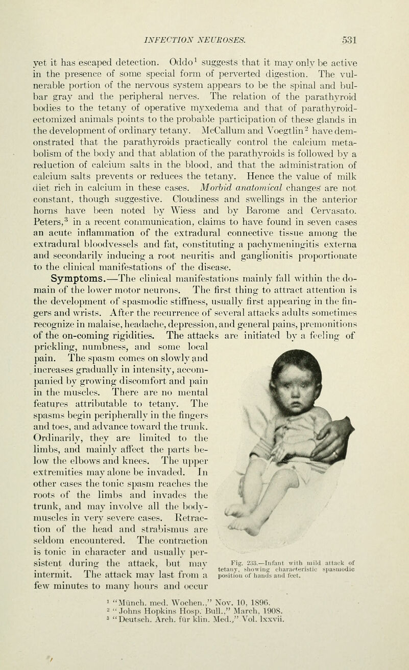 yet it has escaped detection. Oddo^ suggests that it may only be active in the presence of some special form of perverted digestion. The vul- nerable portion of the nervous system appears to be the spinal and bul- bar gray and the peripheral nerves. The relation of the parathyroid bodies to the tetany of operative myxedema and that of parathyroid- ectomized animals points to the probable participation of these glands in the development of ordinary tetany. ^NlcCallum and Voegtlin- have dem- onstrated that the parathyroids practically control the calcium meta- bolism of the body and that ablation of the parathyroids is followed by a reduction of calcium salts in the blood, and that the administration of calcium salts prevents or reduces the tetany. Hence the value of milk diet rich in calcium in these cases. Morbid anatomical changes are not constant, though suggestive. Cloudiness and swellings in the anterior horns have been noted by Wiess and by Barome and Cervasato. Peters,^ in a recent communication, claims to have found in seven cases an acute inflammation of the extradural connective tissue among the extradural bloodvessels and fat, constituting; a pachymeningitis externa and secondarily inducing a root neuritis and ganglionitis proportionate to the clinical manifestations of the disease. Symptoms.—The clinical manifestations mainly fall within the do- main of the lower motor neurons. The first thing to attract attention is the development of spasmodic stiffness, usually first appearing in the fin- gers and wrists. After the recurrence of several attacks adults sometimes recognize in malaise, headache, depression, and general pains, premonitions of the on-coming rigidities. The attacks are initiated by a feeling of prickling, numbness, and some local pain. The spasm comes on slowly and increases gradually in intensity, accom- panied by growing discomfort and pain in the muscles. There are no mental features attributable to tetany. The spasms begin peripherally in the fingers and toes, and advance toward the trunk. Ordinarily, they are limited to the limbs, and mainly affect the parts be- low the elbows and knees. The upper extremities may alone be invaded. In other cases the tonic spasm reaches the roots of the limbs and invades the trunk, and may involve all the body- muscles in very severe cases. Retrac- tion of the head and strabismus are seldom encountered. The contraction is tonic in character and usually ]>er- sistent during the attack, but may intermit. The attack may last from a few minutes to many hours and occur / Fig. 233.—Infant with mild attacli of tetany, showing ciiaraot^ristic spasmodic position of hands and feet. 1 Miinch. med. Wochen., Nov. 10, 1896. 2  Johns Hopkin.s Ho.sp. Bull., March. 1908. 3 Deut.sch. Arch, fur klin. Med., Vol. Ixxvii.