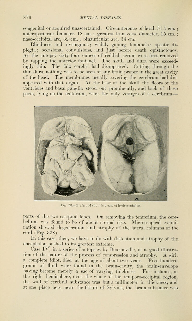 congenital or acquired unascertained. Circumference of head, 51.5 cm.; anteroposterior diameter, 18 cm.; greatest ti'ansverse diameter, 15 cm.; naso-occipital arc, 32 cm.; binauricular arc, 34 cm. Blindness and nystagmus; widely gaping fontanels; spastic di- plegia ; occasional conyulsions, and just before death opisthotonos. At the autopsy sixty-four ounces of reddish serum were first removed by tapping the anterior fontanel. The skull and dura were exceed- ingly thin. The falx cerebri had disappeared. Cutting through the thin dura, nothing was to be seen of any brain proper in the great cavity of the head. The membranes usually covering the cerebrum had dis- appeared with that organ. At the base of the skull the floors of the ventricles and basal ganglia stood out prominently, and back of these parts, lying on the tentorium, were the only vestiges of a cerebrum— -Brain aijJ -kul cephalas. parts of the two occipital lobes. On removing the tentorium, the cere- bellum was found to be of about normal size. Microscopical exami- nation showed degeneration and atrophy of the lateral columns of the cord (Fig. 338). In this case, then, we have to do with distention and atrophy of the encephalon pushed to its greatest extreme. Case IV, in a series of auto23sies by Bourneville, is a good illustra- tion of the nature of the process of compression and atrophv. A girl, a comj^lete idiot, died at the age of about two years. Five hundred grams of fluid were found in the brain-cavity, the brain-envelope having become merely a sac of varying thickness. For instance, in the right hemisphere, over the whole of the temporo-occipital region, the wall of cerebral substance was but a millimeter in thickness, and at one place here, near the fissure of Sylvius, the brain-substance was