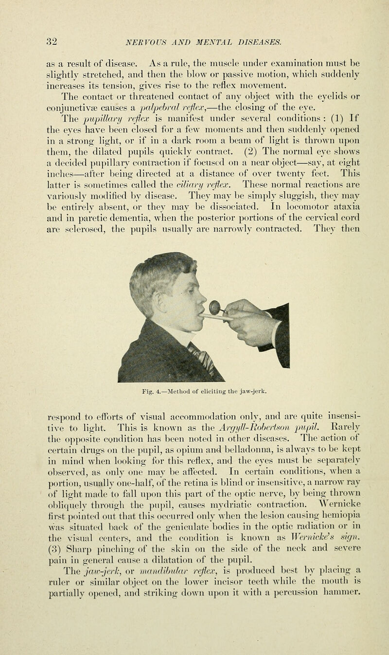 as a result of disease. As a rule, the muscle under examination must be slightly stretched, and then the blow or passive motion, which suddenly increases its tension, gives rise to the reflex movement. The contact or threatened contact of any object with the eyelids or conjunctiva? causes a palpebral reflex,—the closing of the eye. The pupillary reflex is manifest under several conditions : (1) If the eyes have been closed for a few moments and then suddenly opened in a strong light, or if in a dark room a beam of light is thrown upon them, the dilated pupils quickly contract. (2) The normal eye shows a decided pupillary contraction if focused on a near object—say, at eight inches—after being directed at a distance of over twenty feet. This latter is sometimes called the ciliary reflex. These normal reactions are variously modified by disease. They may be simply sluggish, they may be entirely absent, or they may be dissociated. In locomotor ataxia and in paretic dementia, when the posterior portions of the cervical cord are sclerosed, the pupils usually are narrowly contracted. They then Fig. 4.—Method of eliciting the jaw-jerk. respond to efforts of visual accommodation only, and are quite insensi- tive to light. This is known as the Argyll-Robertson pupil. Rarely the opposite condition has been noted in other diseases. The action of certain drugs on the pupil, as opium and belladonna, is always to be kept in mind when looking for this reflex, and the eyes must be separately observed, as only one may be affected. In certain conditions, when a portion, usually one-half, of the retina is blind or insensitive, a narrow ray of light made to fall upon this part of the optic nerve, by being thrown obliquely through the pupil, causes mydriatic contraction. Wernicke first pointed out that this occurred only when the lesion causing hemiopia was situated back of the geniculate bodies in the optic radiation or in the visual centers, and the condition is known as Wernicke's sign. (3) Sharp pinching of the skin on the side of the neck and severe pain in general cause a dilatation of the pupil. The jaw-jerk, or mandibular reflex, is produced best by placing a ruler or similar object on the lower incisor teeth while the mouth is partially opened, and striking down upon it with a percussion hammer.