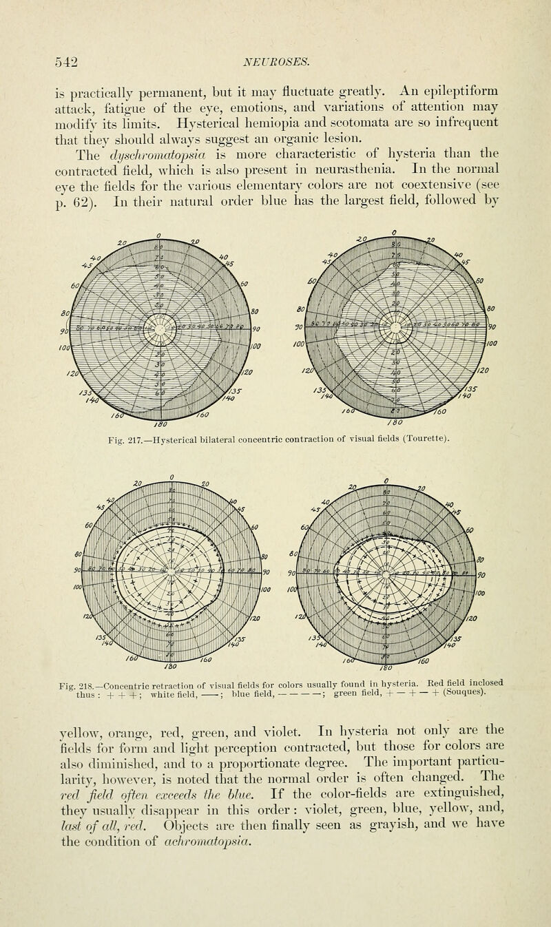 is practically permanent, but it may fluctuate greatly. An epileptiform attack, fatigue of the eye, emotions, and variations of attention may modify its limits. Hysterical hemiopia and scotomata are so infrequent that they should always suggest an organic lesion. The dyschromatopsia is more characteristic of hysteria than the contracted field, which is also present in neurasthenia. In the normal eye the fields for the various elementary colors are not coextensive (see p. 62). In their natural order blue has the largest field, followed by Fig. 217.—Hysterical bilateral concentric contraction of visual fields (Tourette). Fig. 218.—Concentric retraction of visual fields for colors usually found in hysteria. Red field inclosed thus : + + + ; white field, ■; blue field, ; green field, + 1- h (Souques). yellow, orange, red, green, and violet. In hysteria not only are the fields for form and light perception contracted, but those for colors are also diminished, and to a proportionate degree. The important particu- larity, however, is noted that the normal order is often changed. The red field often exceeds the blue. If the color-fields are extinguished, they usually disappear in this order: violet, green, blue, yellow, and, last of all, red. Objects are then finally seen as grayish, and we have the condition of achromatopsia.