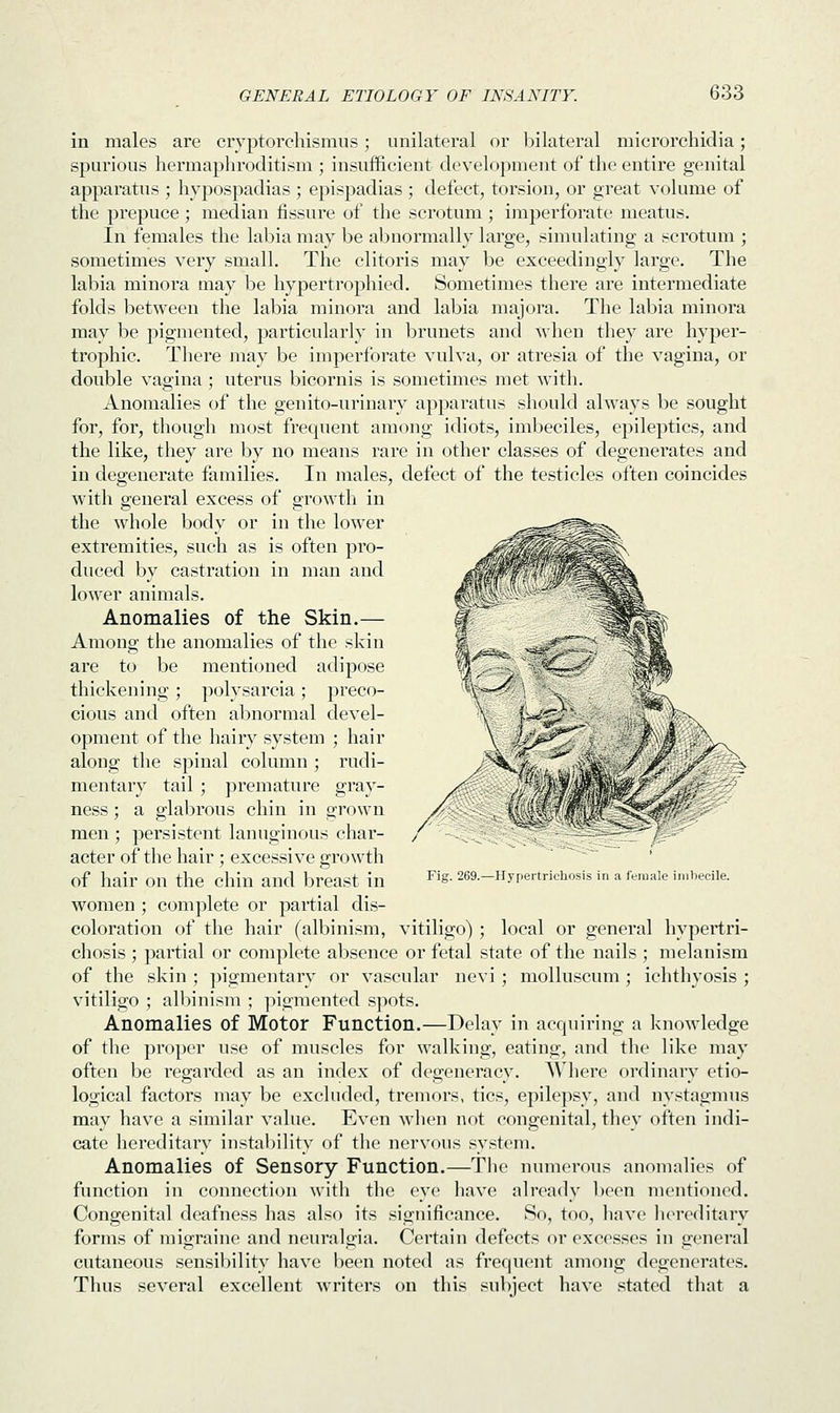 in males are cryptorchismus; unilateral or bilateral microrchidia; spurious hermaphroditism ; insufficient development of the entire genital apparatus ; hypospadias ; epispadias ; defect, torsion, or great volume of the prepuce ; median fissure of the scrotum ; imperforate meatus. In females the labia may be abnormally large, simulating a scrotum ; sometimes very small. The clitoris may be exceedingly large. The labia minora may be hypertrophiecl. Sometimes there are intermediate folds between the labia minora and labia majora. The labia minora may be pigmented, particularly in brunets and when they are hyper- trophic. There may be imperforate vulva, or atresia of the vagina, or double vagina ; uterus bicornis is sometimes met with. Anomalies of the genito-urinary apparatus should always be sought for, for, though most frecpient among idiots, imbeciles, epileptics, and the like, they are by no means rare in other classes of degenerates and in degenerate families. In males, defect of the testicles often coincides with general excess of growth in the whole body or in the lower extremities, such as is often pro- duced by castration in man and lower animals. Anomalies of the Skin.— Among the anomalies of the skin are to be mentioned adipose thickening; polysarcia; preco- cious and often abnormal devel- opment of the hairy system ; hair along the spinal column ; rudi- mentary tail ; premature gray- ness; a glabrous chin in grown men ; persistent lanuginous char- acter of the hair ; excessive growth of hair on the chin and breast in women ; complete or partial dis- coloration of the hair (albinism, wm* Fig. 269.—Hypertrichosis in a female imbecile. local or general hypertri- vitiligo) chosis ; partial or complete absence or fetal state of the nails ; melanism of the skin ; pigmentary or vascular nevi ; molluscum ; ichthyosis ; vitiligo ; albinism ; pigmented spots. Anomalies of Motor Function.—Delay in acquiring a knowledge of the proper use of muscles for walking, eating, and the like may often be regarded as an index of degeneracy. Where ordinary etio- logical factors may be excluded, tremors, tics, epilepsy, and nystagmus may have a similar value. Even when not congenital, they often indi- cate hereditary instability of the nervous system. Anomalies of Sensory Function.—The numerous anomalies of function in connection with the eye have already been mentioned. Congenital deafness has also its significance. So, too, have hereditary forms of migraine and neuralgia. Certain defects or excesses in general cutaneous sensibility have been noted as frequent among degenerates. Thus several excellent writers on this subject have stated that a