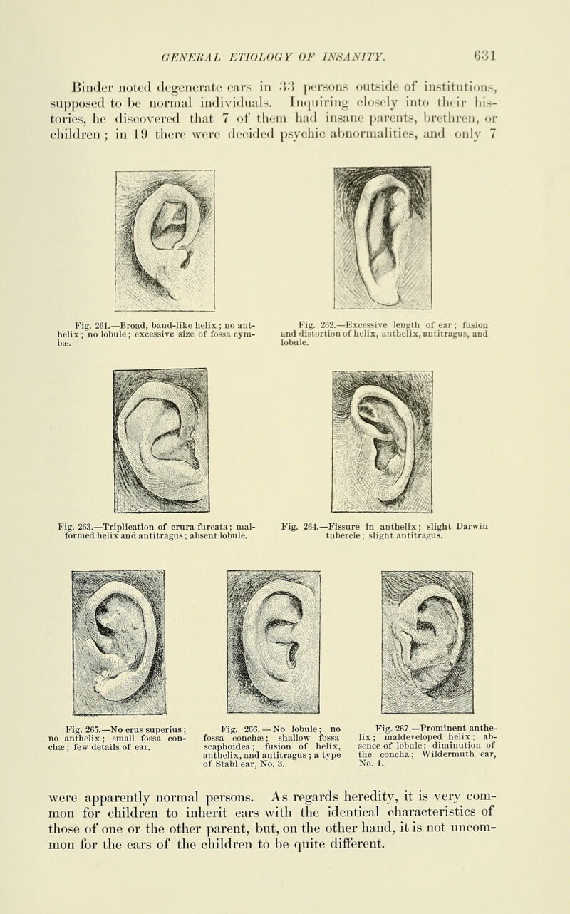 Hinder noted degenerate ears in 33 persons outside of institutions, supposed to be normal individuals. Enquiring closely into their his- tories, he discovered that 7 of them had insane parents, brethren, or children; in 19 there were decided psychic abnormalities, and only 7 Fig. 261.—Broad, baud-like helix; no ant- helix ; no lobule; excessive size of fossa cym- bse. Fig. 262.—Excessive length of ear ; fusion and distortion of helix, anthelix, antitragus, and lobule. Fig. 263.—Triplication of crura furcata; mal- formed helix and antitragus; absent lobule. Fig. 264.—Fissure in anthelix; slight Darwin tubercle; slight antitragus. Fig. 265.—No crus superius; no anthelix; small fossa con- chse; few details of ear. Fig. 266.—No lobule; no fossa concha; shallow fossa scaphoidea; fusion of helix, anthelix, and antitragus ; a type of Stahl ear, No. 3. Fig. 267.—Prominent anthe- lix; maldeveloped helix; ab- sence of lobule; diminution of the concha; Wilderniuth ear, No. 1. were apparently normal persons. As regards heredity, it is very com- mon for children to inherit ears with the identical characteristics of those of one or the other parent, but, on the other hand, it is not uncom- mon for the ears of the children to be quite different.