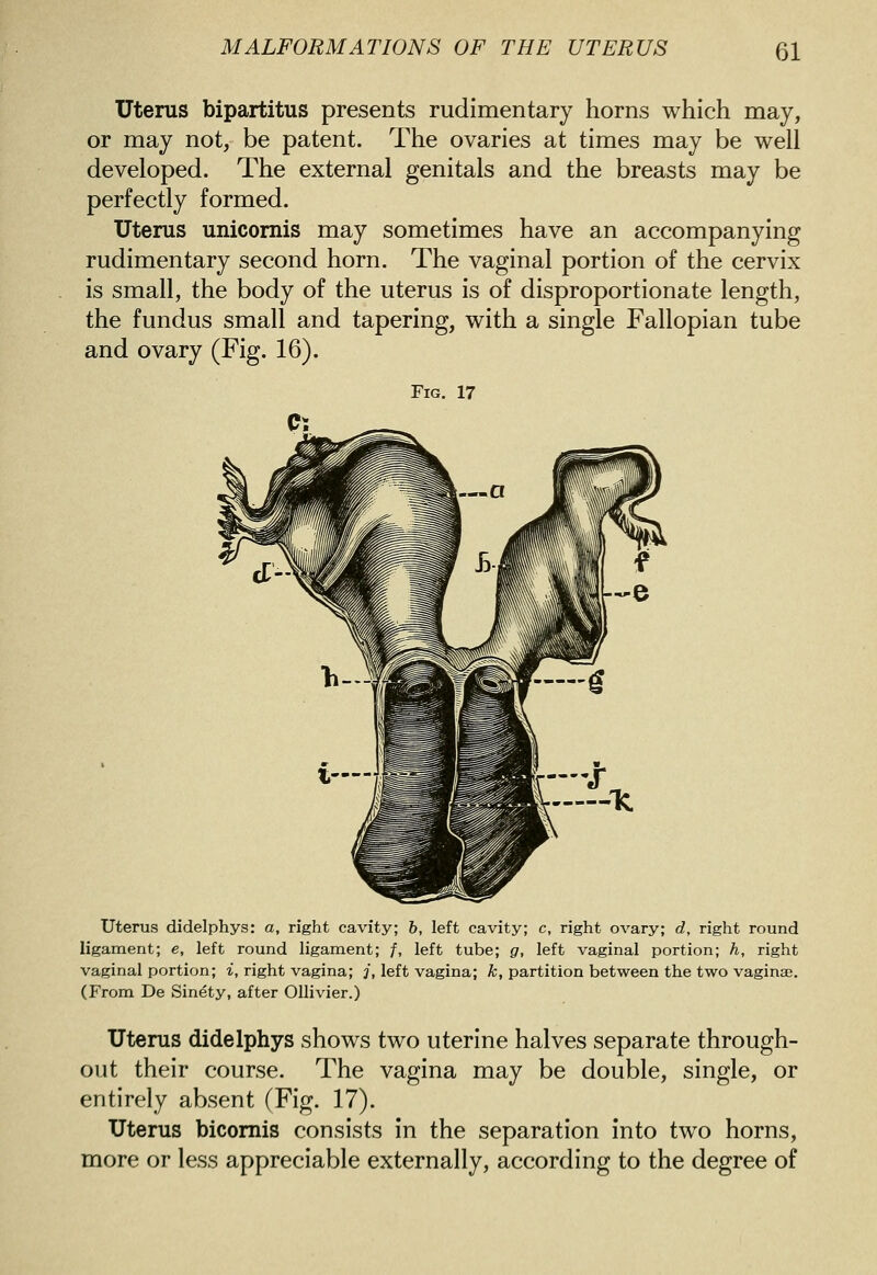 Uterus bipartitus presents rudimentary horns which may, or may not, be patent. The ovaries at times may be well developed. The external genitals and the breasts may be perfectly formed. Uterus unicornis may sometimes have an accompanying rudimentary second horn. The vaginal portion of the cervix is small, the body of the uterus is of disproportionate length, the fundus small and tapering, with a single Fallopian tube and ovary (Fig. 16). Fig. 17 Uterus didelphys: a, right cavit_ . ?. I ft ty; c, right OA^ary; d, right round ligament; e, left round ligament; f, left tube; g, left vaginal portion; h, right vaginal portion; i, right vagina; j, left vagina; k, partition between the two vagina;. (From De Sinety, after Ollivier.) Uterus didelphys shows two uterine halves separate through- out their course. The vagina may be double, single, or entirely absent (Fig. 17). Uterus bicomis consists in the separation into two horns, more or less appreciable externally, according to the degree of