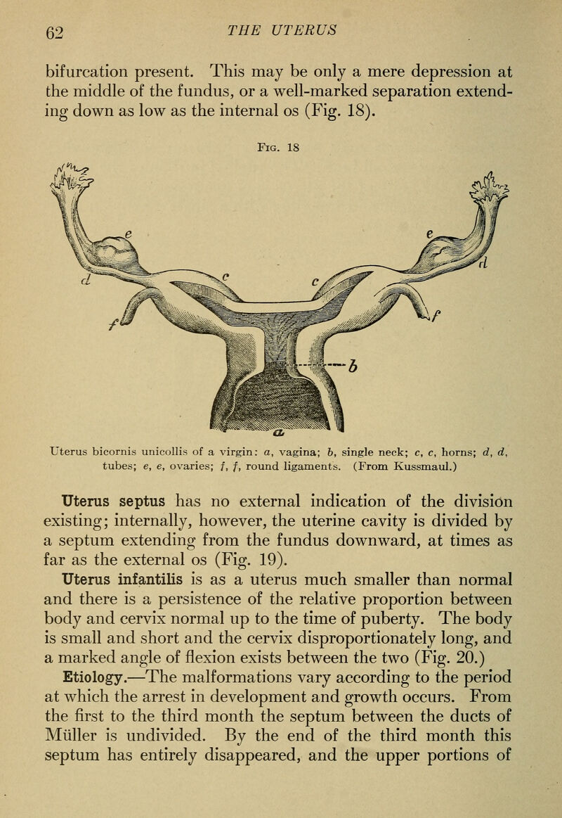 bifurcation present. This may be only a mere depression at the middle of the fundus, or a well-marked separation extend- ing down as low as the internal os (Fig. 18). Fig. 18 ■f^vT Uterus bicornis unicollis of a virgin: a, vagina; 6, single neck; c, c, horns; d, d, tubes; e, e, ovaries; /, /, round ligaments. (From Kussmaul.) Uterus septus has no external indication of the division existing; internally, however, the uterine cavity is divided by a septum extending from the fundus downward, at times as far as the external os (Fig. 19). Uterus infantilis is as a uterus much smaller than normal and there is a persistence of the relative proportion between body and cervix normal up to the time of puberty. The body is small and short and the cervix disproportionately long, and a marked angle of flexion exists between the two (Fig. 20.) Etiology.—The malformations vary according to the period at which the arrest in development and growth occurs. From the first to the third month the septum between the ducts of Miiller is undivided. By the end of the third month this septum has entirely disappeared, and the upper portions of