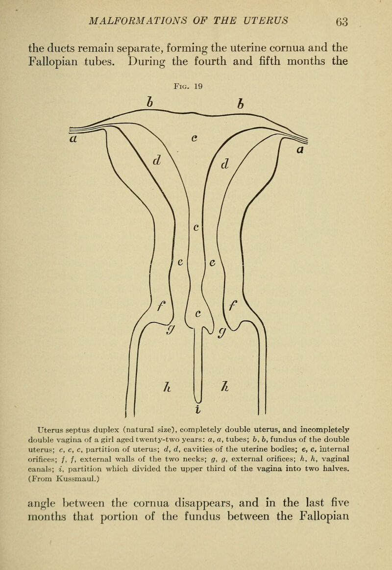 the ducts remain separate, forming the uterine cornua and the Fallopian tubes. During the fourth and fifth months the Fig. 19 Uterus septus duplex (natural size), completely double uterus, and incompletely double vagina of a girl aged twenty-two years: a, a, tubes; &, h, fundus of the double uterus; c, c, c, partition of uterus; d, d, cavities of the uterine bodies; e, e, internal orifices; /, f, external walls of the two necks; g, g, external orifices; h, h, vaginal canals; i, partition which divided the upper third of the vagina into two halves. (From Kussmaul.) angle between the cornua disappears, and in the last five months that portion of the fundus between the Fallopian