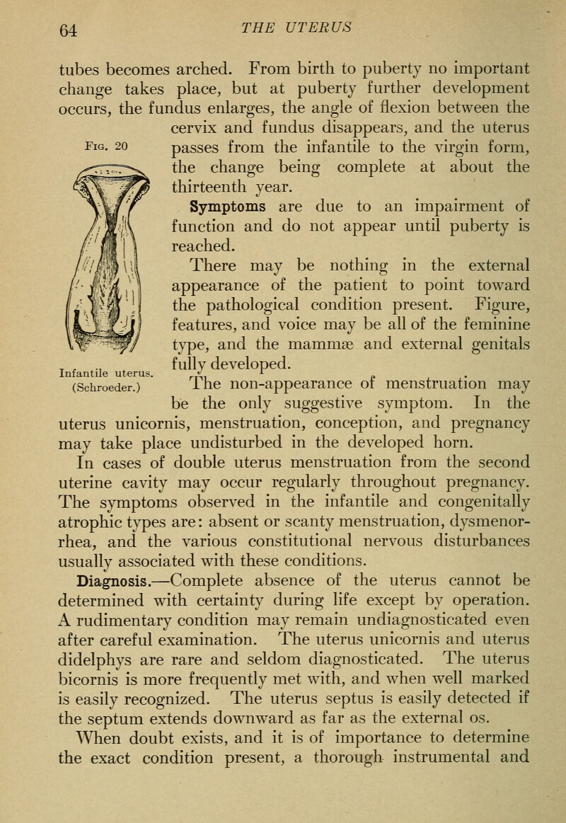 Fig. 20 Infantile uterus. (Schroeder.) tubes becomes arched. From birth to puberty no important change takes place, but at puberty further development occurs, the fundus enlarges, the angle of flexion between the cervix and fundus disappears, and the uterus passes from the infantile to the virgin form, the change being complete at about the thirteenth year. Symptoms are due to an impairment of function and do not appear until puberty is reached. There may be nothing in the external appearance of the patient to point toward the pathological condition present. Figure, features, and voice may be all of the feminine type, and the mammse and external genitals fully developed. The non-appearance of menstruation may be the only suggestive symptom. In the uterus unicornis, menstruation, conception, and pregnancy may take place undisturbed in the developed horn. In cases of double uterus menstruation from the second uterine cavity may occur regularly throughout pregnancy. The symptoms observed in the infantile and congenitally atrophic types are: absent or scanty menstruation, dysmenor- rhea, and the various constitutional nervous disturbances usually associated with these conditions. Diagnosis.—Complete absence of the uterus cannot be determined with certainty during life except by operation. A rudimentary condition may remain undiagnosticated even after careful examination. The uterus unicornis and uterus didelphys are rare and seldom diagnosticated. The uterus bicornis is more frequently met with, and when well marked is easily recognized. The uterus septus is easily detected if the septum extends downward as far as the external os. When doubt exists, and it is of importance to determine the exact condition present, a thorough instrumental and