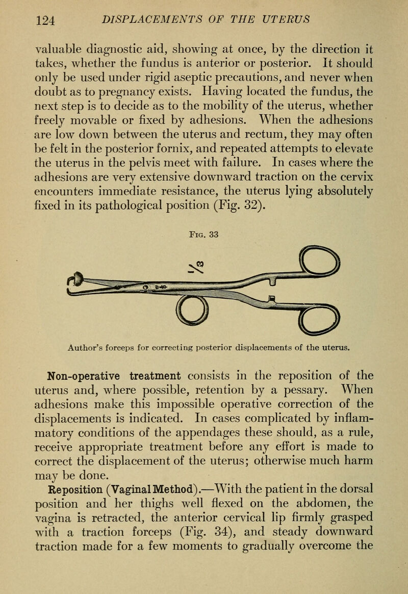 valuable diagnostic aid, showing at once, by the direction it takes, whether the fundus is anterior or posterior. It should only be used under rigid aseptic precautions, and never when doubt as to pregnancy exists. Having located the fundus, the next step is to decide as to the mobility of the uterus, whether freely movable or fixed by adhesions. When the adhesions are low down between the uterus and rectum, they may often be felt in the posterior fornix, and repeated attempts to elevate the uterus in the pelvis meet with failure. In cases where the adhesions are very extensive downward traction on the cervix encounters immediate resistance, the uterus lying absolutely fixed in its pathological position (Fig. 32). Fig. 33 Author's forceps for correcting posterior displacements of the uterus. Non-operative treatment consists in the reposition of the uterus and, where possible, retention by a pessary. When adhesions make this impossible operative correction of the displacements is indicated. In cases complicated by inflam- matory conditions of the appendages these should, as a rule, receive appropriate treatment before any effort is made to correct the displacement of the uterus; otherwise much harm may be done. Reposition (VaginalMethod).—With the patient in the dorsal position and her thighs well flexed on the abdomen, the vagina is retracted, the anterior cervical lip firmly grasped with a traction forceps (Fig. 34), and steady downward traction made for a few moments to gradually overcome the