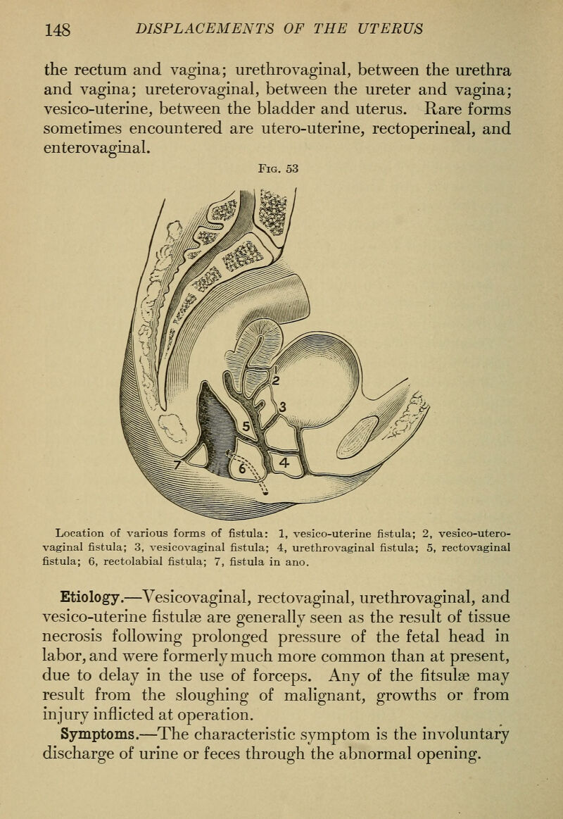 the rectum and vagina; urethrovaginal, between the urethra and vagina; ureterovaginal, between the ureter and vagina; vesico-uterine, between the bladder and uterus. Rare forms sometimes encountered are utero-uterine, rectoperineal, and enterovaginal. Fig. 53 Location of various forms of fistula: 1, vesico-uterine fistula; 2, vesico-utero- vaginal fistula; 3, vesicovaginal fistula; 4, urethrovaginal fistula; 5, rectovaginal fistula; 6, rectolabial fistula; 7, fistula in ano. Etiology.—Vesicovaginal, rectovaginal, urethrovaginal, and vesico-uterine fistulse are generally seen as the result of tissue necrosis following prolonged pressure of the fetal head in labor, and were formerly much more common than at present, due to delay in the use of forceps. Any of the fitsulse may result from the sloughing of malignant, growths or from injury inflicted at operation. Symptoms.—The characteristic symptom is the involuntary discharge of urine or feces through the abnormal opening.