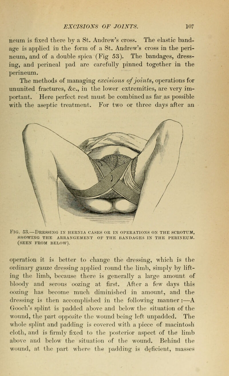 neum is fixed there by a St. Andrew's cross. The elastic band- age is applied in the form of a St. Andrew's cross in the peri- neum, and of a double spica (Fig 53). The bandages, dress- ing, and perineal pad are carefully pinned together in the perineum. The methods of managing excisions of joints^ operations for ununited fractures, &c., in the lower extremities, are very im- portant. Here jjerfect rest must be combined as far as possible with the aseptic treatment. For two or three days after an Fig. 53.—Dressing in hernia cases or in operations on the scrotum, showing the arrangement op the bandages in the perineum. (seen from BELOW). operation it is better to change the dressing, which is the ordinary gauze dressing applied round the limb, simply by lift- ing the limb, because there is generally a large amount of bloody and serous oozing at first. After a few days this oozing has become much diminished in amount, and the dressing is then accomplished in the following manner :—A Gooch's splint is padded above and below the situation of the wound, the part opposite the wound being left unpadded. The whole splint and padding is covered with a piece of macintosh cloth, and is firmly fixed to the posterior aspect of the limb above and below the situation of tlie wound. Behind the wound, at the part where tlif jjadding is deficient, masses