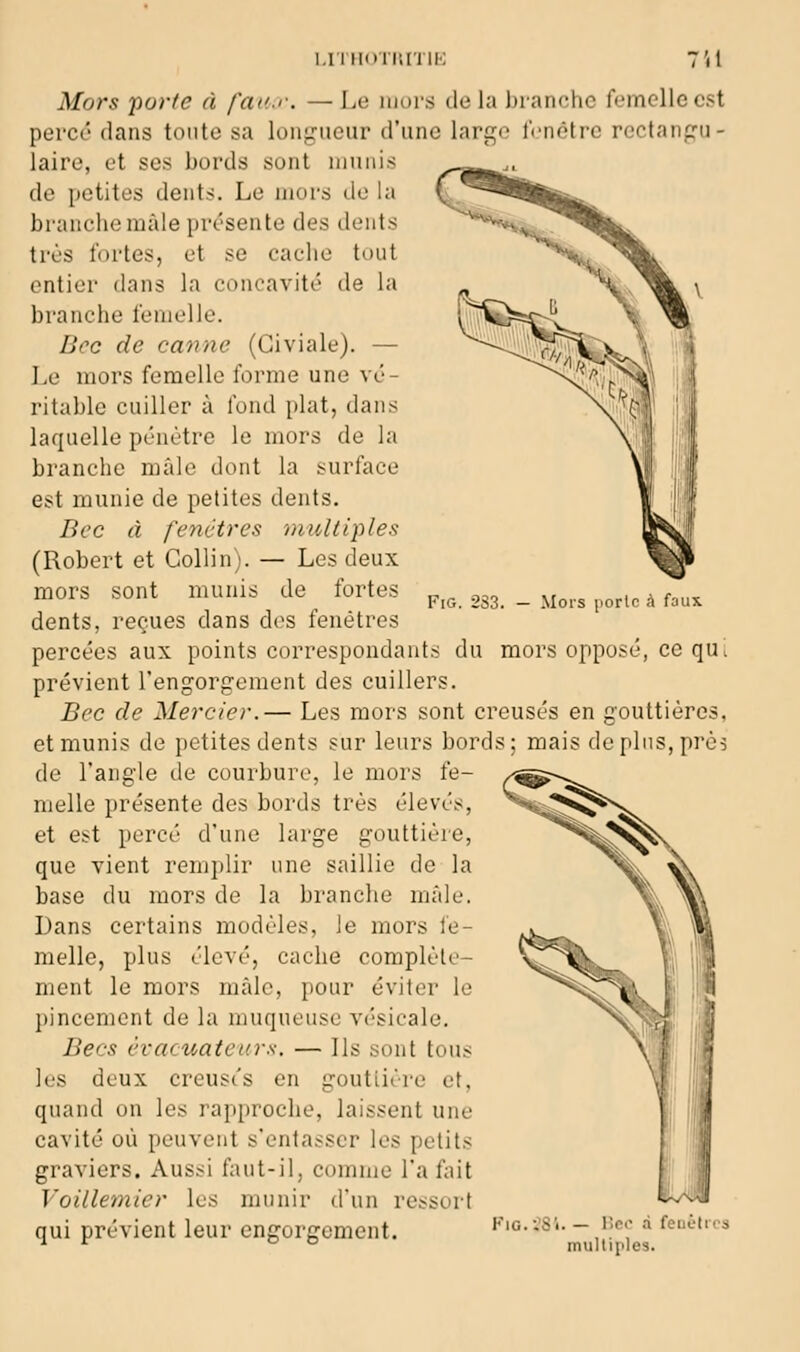 FiG. 2S3. - Mors l'orlc à faux I.ITHOTKITIK TU Mors porte à fan.'-. — Le luors de la branche femelle est perce dans tonte sa longueur d'une large lenétrc rectan{i:u- laire, et ses bords sont niniiis de petites dents. Le mors de la branche mâle présente des dents très fortes, et se caclie tout entier dans la concavité de la l)ranche femelle. Boc de canne (Giviale). — Le mors femelle forme une vé- ritable cuiller à fond plat, dans laquelle pénètre le mors de la branche mâle dont la surface est munie de petites dents. Bec â fenêtres multiplet (Robert et CoUin). — Les deux mors sont munis de fortes dents, reçues dans d<>s fenêtres percées aux points correspondants du mors opposé, ce qu^ prévient l'engorgement des cuillers. Bec de Mercier,— Les mors sont creusés en gouttières, et munis de petites dents sur leurs bords; mais de plus, près de l'angle de courbure, le mors fe- melle présente des bords très élevés, et est percé d'une large gouttière, que vient remplir une saillie de la base (lu mors de la branche mîde. Dans certains modèles, le mors fe- melle, plus élevé, cache complète- ment le mors mfdo, pour éviter le jiincement de la muqueuse vésicale. Becs èvacuateiirs. — Ils sont tous les deux creusés en gouttière et, quand aw les rapproche, laissent une cavité où peuvent s'entasser les petits graviers. Aussi faut-il, comme l'a fait \'oillemier les munir d'un ressort qui prévient leur engorgement. Fig.-.'SI. -';<=•' à fenêtres ^ '^ cj o multiples.