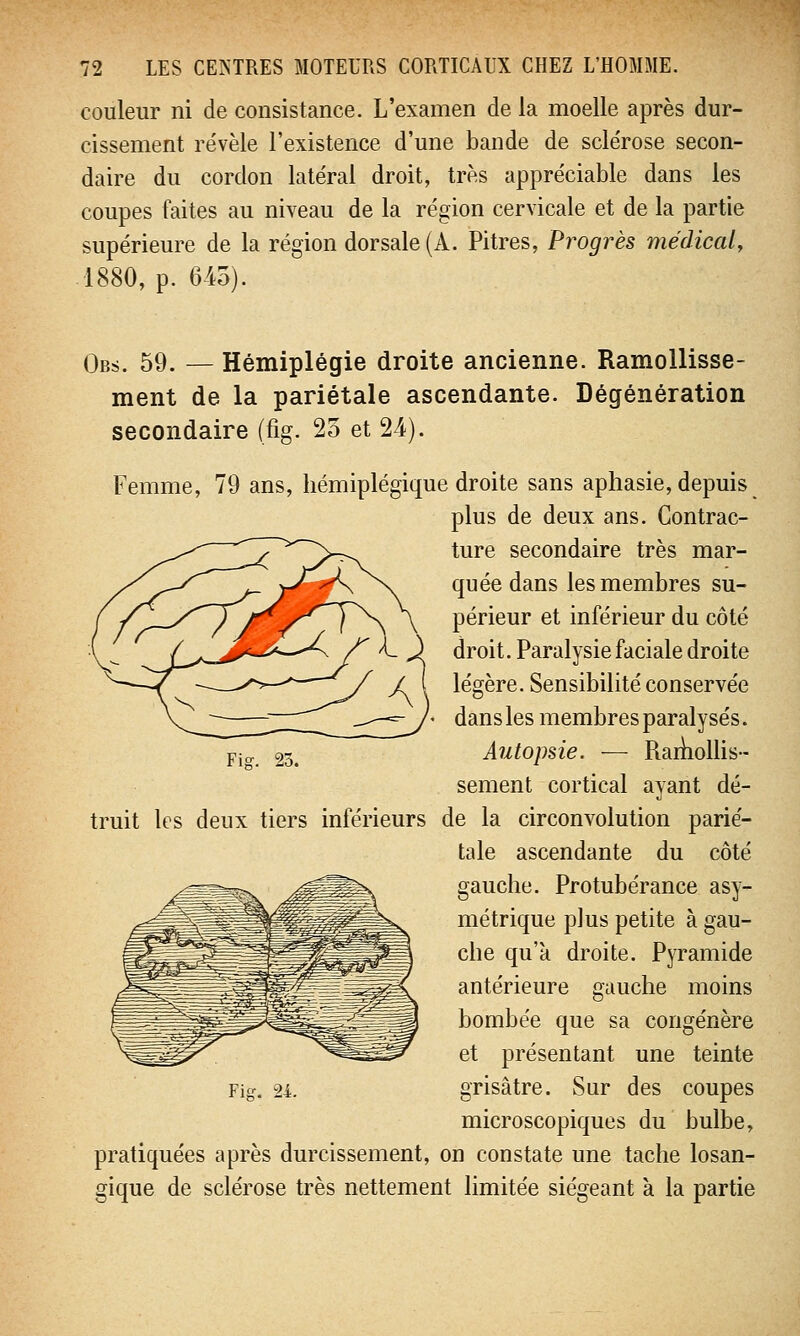 couleur ni de consistance. L'examen de la moelle après dur- cissement révèle l'existence d'une bande de sclérose secon- daire du cordon latéral droit, très appréciable dans les coupes faites au niveau de la région cervicale et de la partie supérieure de la région dorsale (À. Pitres, Progrès médical, 1880, p. 645). Fie. 23. Obs. 59. — Hémiplégie droite ancienne. Ramollisse- ment de la pariétale ascendante. Dégénération secondaire (fig. 25 et 24). Femme, 79 ans, bémiplégique droite sans aphasie, depuis plus de deux ans. Contrac- ture secondaire très mar- quée dans les membres su- périeur et inférieur du côté droit. Paralysie faciale droite légère. Sensibilité conservée dans les membres paralysés. Autopsie. — Ramollis- sement cortical ayant dé- truit les deux tiers inférieurs de la circonvolution parié- tale ascendante du côté gauche. Protubérance asy- métrique plus petite à gau- che qu'à droite. Pyramide antérieure gauche moins bombée que sa congénère et présentant une teinte microscopiques du bulbe, pratiquées après durcissement, on constate une tache losan- gique de sclérose très nettement limitée siégeant à la partie