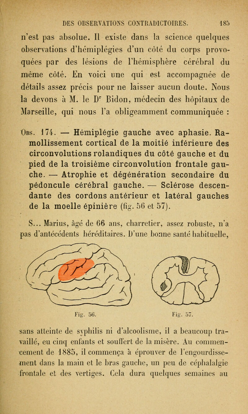 n'est pas absolue. Il existe dans la science quelques observations d'hémiplégies d'un côté du corps provo- quées par des lésions de l'hémisphère cérébral du même côté. En voici une qui est accompagnée de détails assez précis pour ne laisser aucun doute. Nous la devons à M. le Dr Bidon, médecin des hôpitaux de Marseille, qui nous l'a obligeamment communiquée : Obs. 174. — Hémiplégie gauche avec aphasie. Ra- mollissement cortical de la moitié inférieure des circonvolutions rolandiques du côté gauche et du pied de la troisième circonvolution frontale gau- che. — Atrophie et dégénération secondaire du pédoncule cérébral gauche. — Sclérose descen- dante des cordons antérieur et latéral gauches de la moelle épinière (fig. 56 et 57). S... Marius, âgé de 66 ans, charretier, assez robuste, n'a pas d'antécédents héréditaires. D'une bonne santé habituelle, Fis. 56. Fig-. sans atteinte de syphilis ni d'alcoolisme, il a beaucoup tra- vaillé, eu cinq enfants et souffert de la misère. Au commen- cement de 1885, il commença à éprouver de l'engourdisse- ment dans la main et le bras gauche, un peu de céphalalgie frontale et des vertiges. Cela dura quelques semaines au