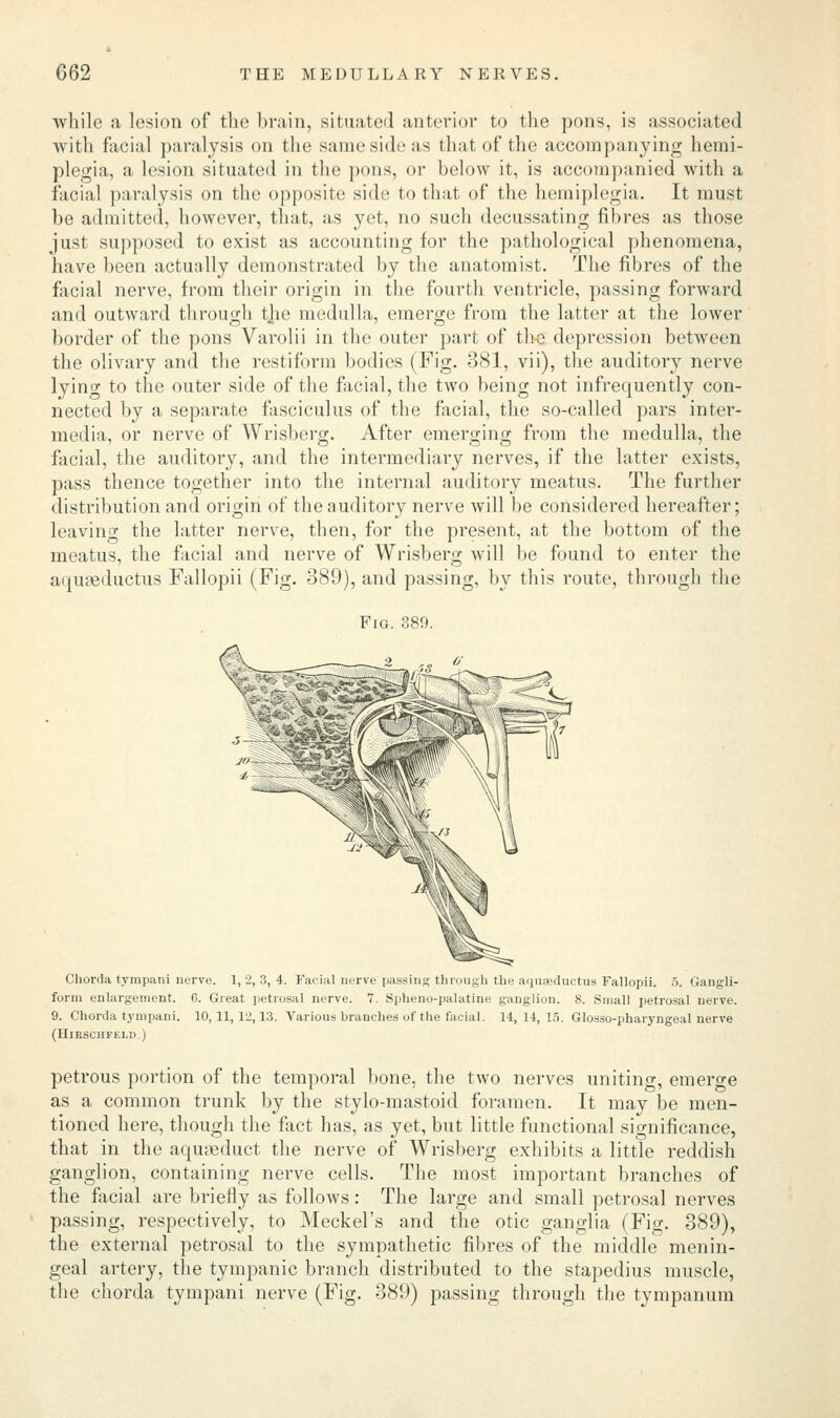 while a lesion of the brain, situated anterior to the pons, is associated ■with facial paralysis on the same side as that of the accompanying hemi- plegia, a lesion situated in the pons, or below it, is accompanied with a facial paralysis on the opposite side to that of the hemiplegia. It must be admitted, however, that, as yet, no such decussating fibres as those just supposed to exist as accounting for the pathological phenomena, have been actually demonstrated by the anatomist. The fibres of the facial nerve, from their origin in the fourth ventricle, passing forward and outward through tjie medulla, emerge from the latter at the lower border of the pons Varolii in the outer part of the depression between the olivary and the restiform bodies (Fig. 381, vii), the auditory nerve lying to the outer side of the facial, the two being not infrequently con- nected by a separate fasciculus of the facial, the so-called pars inter- media, or nerve of Wrisberg. After emerging from the medulla, the facial, the auditory, and the intermediary nerves, if the latter exists, pass thence together into the internal auditory meatus. The further distribution and origin of the auditory nerve will be considered hereafter; leaving the latter nerve, then, for the present, at the bottom of the meatus, the facial and nerve of Wrisberg will be found to enter the aquseductus Fallopii (Fig. 389), and passing, by this route, through the Fig. 389. Chorda tympani nerve. 1, 2, 3, 4. Facial nerve passing through the aquseductua Fallopii. 5. Gangli- form enlargement. G. Great petrosal nerve. 7. Spheno-palatine ganglion. 8. Small petrosal nerve. 9. Chorda tympani. 10,11,1-2,13. Various branches of the facial. 14, 14, IS. Glosso-pharyngeal nerve (HlRSCHFELD.) petrous portion of the temporal bone, the two nerves uniting, emerge as a common trunk by the stylo-mastoid foramen. It may be men- tioned here, though the fact has, as yet, but little functional significance, that in the aqugeduct the nerve of Wrisberg exhibits a little reddish ganglion, containing nerve cells. The most important branches of the facial are briefly as follows: The large and small petrosal nerves passing, respectively, to Meckel's and the otic ganglia (Fig. 389), the external petrosal to the sympathetic fibres of the middle menin- geal artery, the tympanic branch distributed to the stapedius muscle, the chorda tympani nerve (Fig. 389) passing through the tympanum