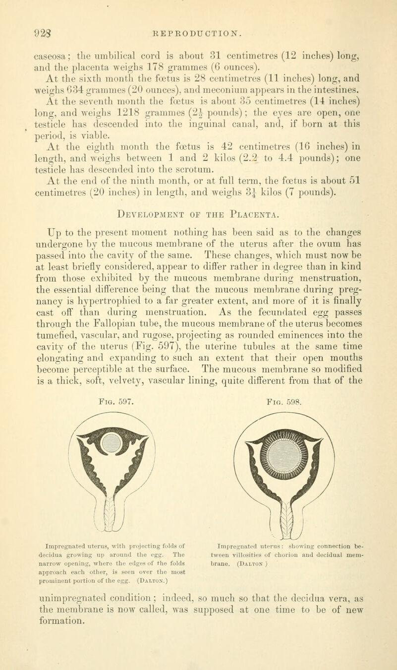 caseosa; the umbilical cord is about 31 centimetres (12 inches) long, ami the placenta weighs 178 grammes (6 ounces). At the sixth month the foetus is 28 centimetres (11 inches) long, and weighs 634 grammes (20 ounces), and meconium appears in the intestines. At the seventh month the foetus is about 35 centimetres (11 inches) long, and weighs 1218 grammes (2| pounds); the eyes are open, one testicle has descended into the inguinal canal, and, if born at this period, is viable. At the eighth month the foetus is 42 centimetres (16 inches) in length, and weighs between 1 and 2 kilos (2.2 to 4.4 pounds); one testicle has descended into the scrotum. At the end of the ninth month, or at full term, the foetus is about 51 centimetres (20 inches) in length, and weighs 3^ kilos (7 pounds). Development of the Placenta. Up to the present moment nothing has been said as to the changes undergone by the mucous membrane of the uterus after the ovum has passed into the cavity of the same. These changes, which must now be at least briefly considered, appear to differ rather in degree than in kind from those exhibited by the mucous membrane during menstruation, the essential difference being that the mucous membrane during preg- nancy is hypertrophied to a far greater extent, and more of it is finally cast off than during menstruation. As the fecundated egg passes through the Fallopian tube, the mucous membrane of the uterus becomes tumefied, vascular, and rugose, projecting as rounded eminences into the cavity of the uterus (Fig. 597), the uterine tubules at the same time elongating and expanding to such an extent that their open mouths become perceptible at the surface. The mucous membrane so modified is a thick, soft, velvety, vascular lining, quite different from that of the Fig. 597. Fio. 598. Impregnated uterus, with projecting folds of decidua growing up around the egg. The narrow opening, where the edges of the folds approach each other, is seen over the most prominent portion of the egg. (Dalton.) Impregnated uterus: showing connection be- tween villosities of chorion and decidual mem- brane. (Dalton ) unimpregnated condition; indeed, so much so that the decidua vera, as the membrane is now called, was supposed at one time to be of new formation.