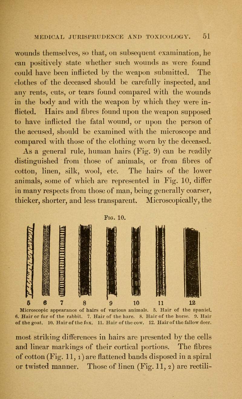 wounds themselves, so that, on subsequent examination, he can positively state whether such wounds as were found could have been inflicted by the weapon submitted. The clothes of the deceased should be carefully inspected, and any rents, cuts, or tears found compared with the wounds in the body and with the weapon by which they were in- flicted. Hairs and fibres found upon the weapon supposed to have inflicted the fatal wound, or upon the person of the accused, should be examined with the microscope and compared with those of the clothing worn by the deceased. As a general rule, human hairs (Fig. 9) can be readily distinguished from those of animals, or from fibres of cotton, linen, silk, wool, etc. The hairs of the lower animals, some of which are represented in Fig. 10, differ in many respects from those of man, being generally coarser, thicker, shorter, and less transparent. Microscopically, the Fig. 10. 6 6 7 8 9 10 11 12 Microscopic appearance of hairs of various animals. 5. Hair of the spaniel. 6. Hair or fur of the rabbit. 7. Hair of the hare. 8. Hair of the horse. 9. Hair of the goat. 10. Hair of the fox. 11, Hair of the cow. 12. Hair of the fallow deer. most striking differences in hairs are presented by the cells and linear markings of their cortical portions. The fibres of cotton (Fig. 11, i) are flattened bands disposed in a spiral or twisted manner. Those of linen (Fig. 11, 2) are rectili-