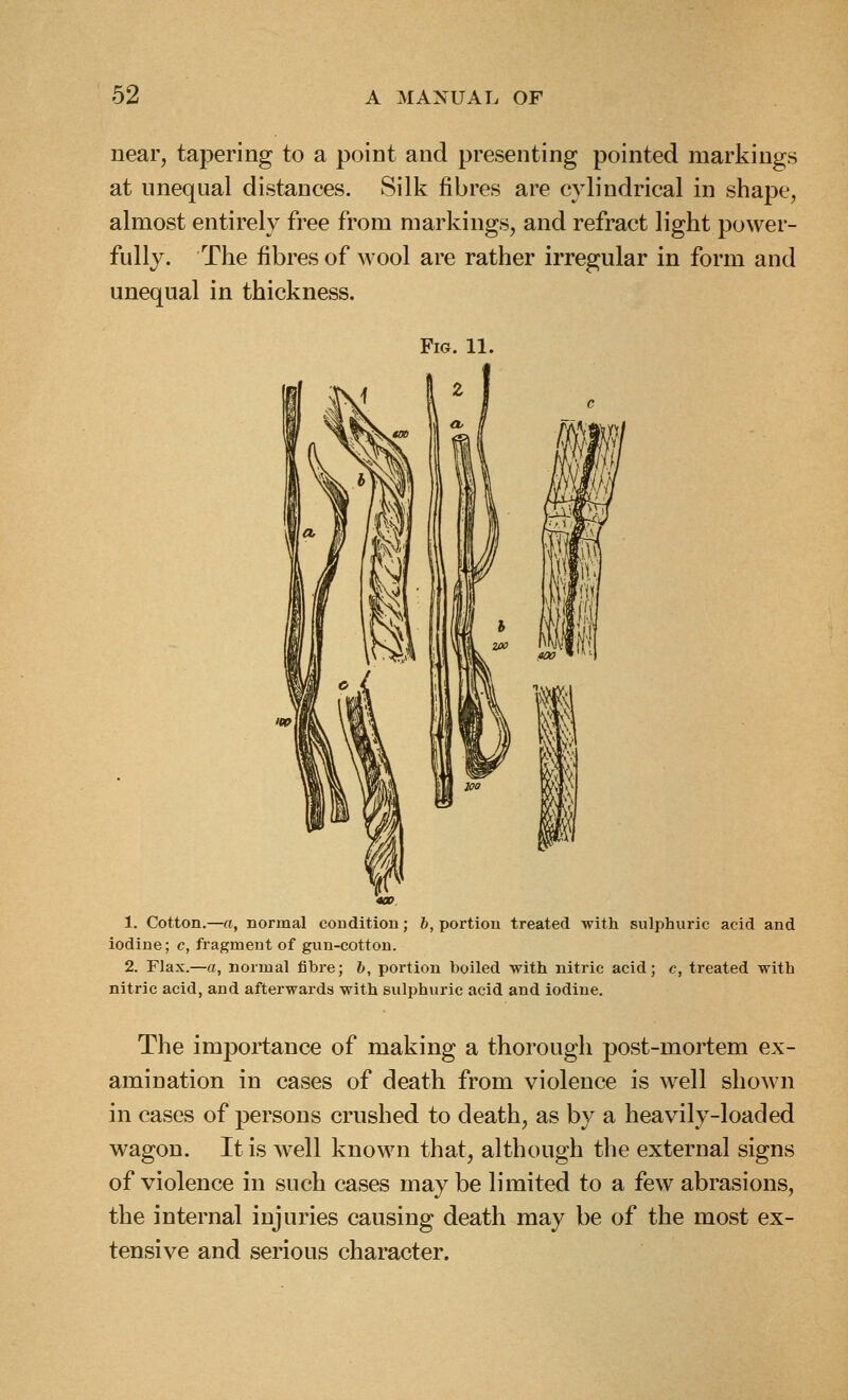 near, tapering to a point and presenting pointed markings at unequal distances. Silk fibres are cylindrical in shape, almost entirely free from markings, and refract light power- fully. The fibres of wool are rather irregular in form and unequal in thickness. Fig. 11. 1. Cotton.—rt, normal condition; b, portion treated with sulphuric acid and iodine; c, fragment of gun-cotton. 2. Flax.—a, normal fibre; b, portion boiled with nitric acid; c, treated with nitric acid, and afterwards with sulphuric acid and iodine. The importance of making a thorough post-mortem ex- amination in cases of death from violence is well shown in cases of persons crushed to death, as by a heavily-loaded wagon. It is well known that, although the external signs of violence in such cases may be limited to a few abrasions, the internal injuries causing death may be of the most ex- tensive and serious character.