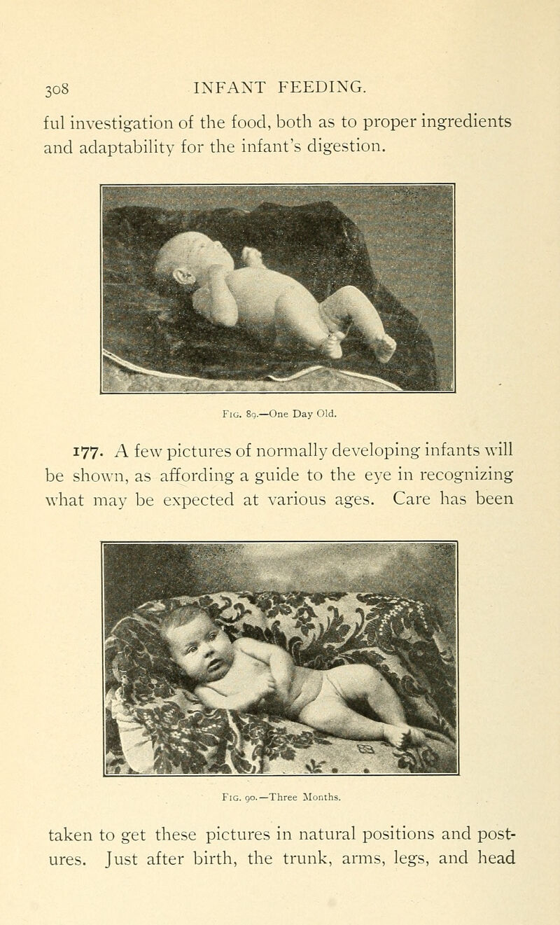 ful investigation of the food, both as to proper ingredients and adaptabihty for the infant's digestion. Fig. 8q.—One Day < Md. 177. A few pictures of normally developing infants will be shown, as affording a guide to the eye in recognizing what may be expected at various ages. Care has been mr- ' IMI^M ■ .-■■, .,,._:, ,...; -** f ^ate^H^H ^ft;. -It ^mBm^^EB ^^^ Fig. 90.—Three Months. taken to get these pictures in natural positions and post- ures. Just after birth, the trunk, arms, legs, and head