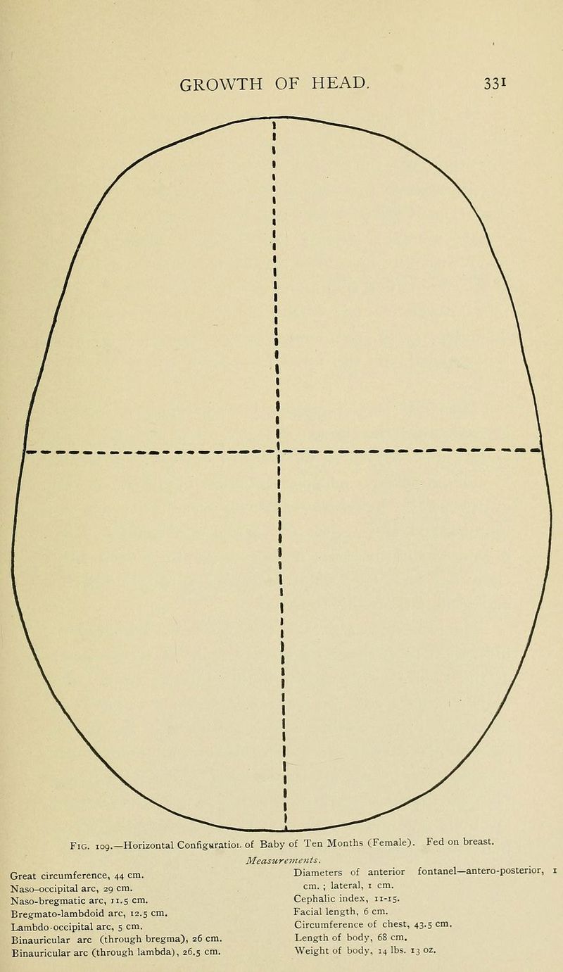 Fed on breast. Fig. 109.—Horizontal Configuratioi, of Baby of Ten Months (Female). Measurements. Great circumference, 44 cm. Diameters of anterior fontanel-antero-posterior, Naso-occipital arc, 29 cm. cm. ; lateral, i cm. Naso-bregmatic arc, ii.s cm. Cephalic index, 11-15. Bregmato-lambdoid arc, 12.5 cm. Facial length, 6 cm. Lambdo-occipital arc, 5 cm. Circumference of chest, 43.5 cm. Binauricular arc (through bregma), 26 cm. Length of body, 68 cm. Binauricular arc (through lambda), 26.5 cm. Weight of body, 14 lbs. 13 oz.