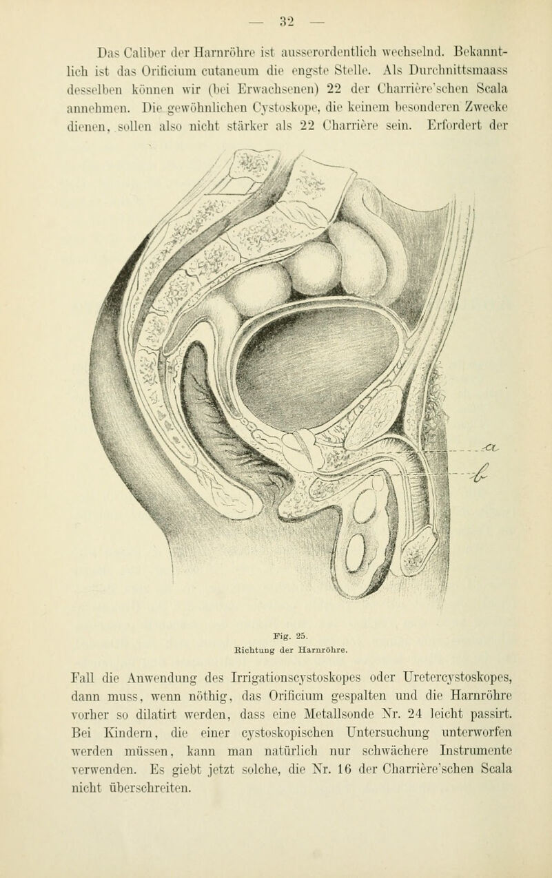 Das Calibor dor Harnrölin> ist ausserordontlic'h wechsehul. Bekannt- lich ist das Oriüeiuni cutaneuni die engste Stelle. Als Durchnittsmaass desselben können wir (bei Erwachsenen) 22 der rbaniere'schen Scala annehmen. Die gt'wühnliehen Cystoskope. die keini-m l)esundt>ren Zwecke dienen, .sollen also nicht stärker als 22 C'harriere sein. Erfordert der ^ v/ Fig. 25. Eichtung der Harnröhre. Fall die Anwendung des Irrigationscj'stoskopes oder Uretercystoskopes, dann muss, wenn uöthig, das Orificium gespalten und die Harnröhre vorher so dilatirt werden, dass eine Metallsonde Nr. 24 leicht passirt. Bei lündera, die einer cj^stoskopischen Untersuchung unterworfen werden müssen, kann man natürlich nur schwächere Instrumente verwenden. Es giebt jetzt solche, die Nr. 16 der Charriere'sehen Scala nicht überschreiten.